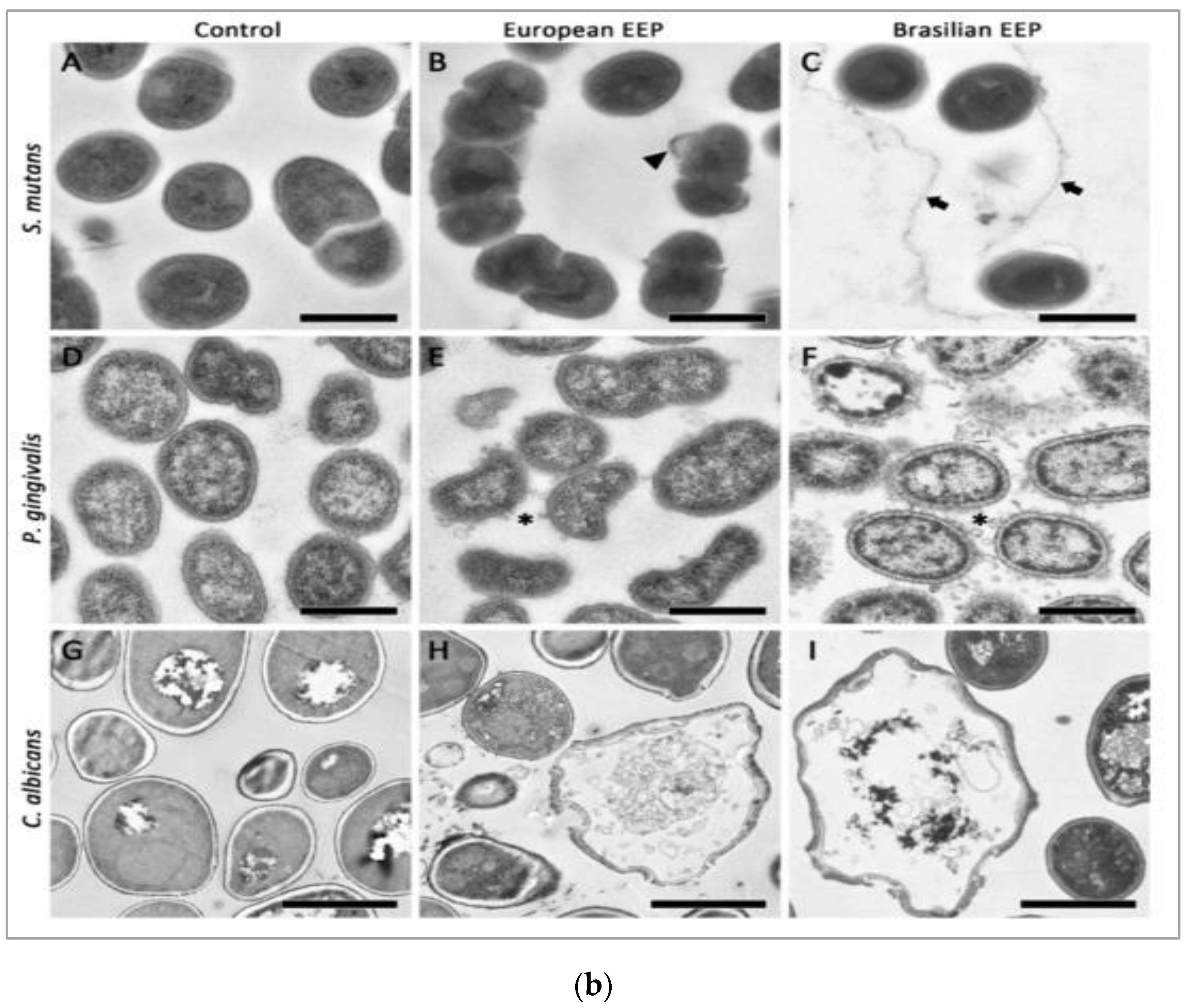 Antioxidants 11 00823 g002b
