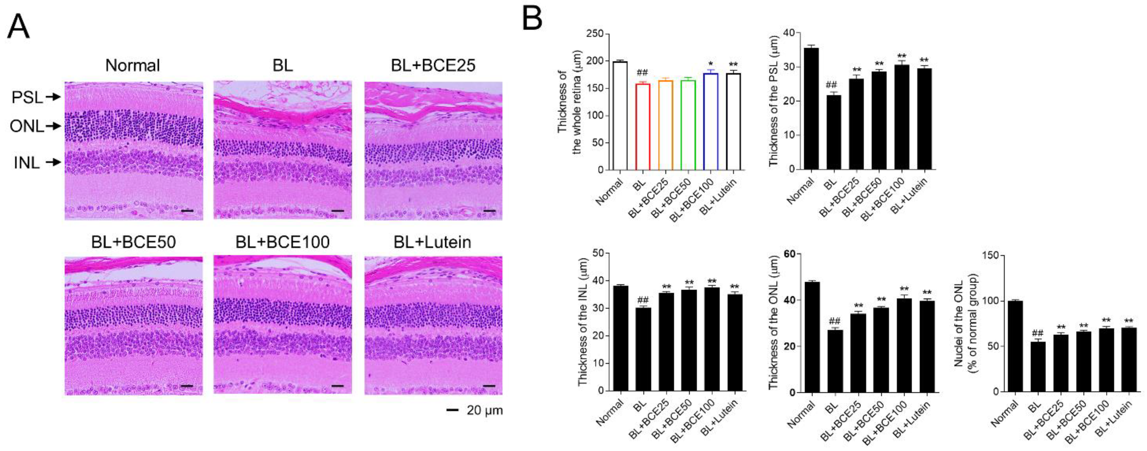 Antioxidants 11 00832 g004