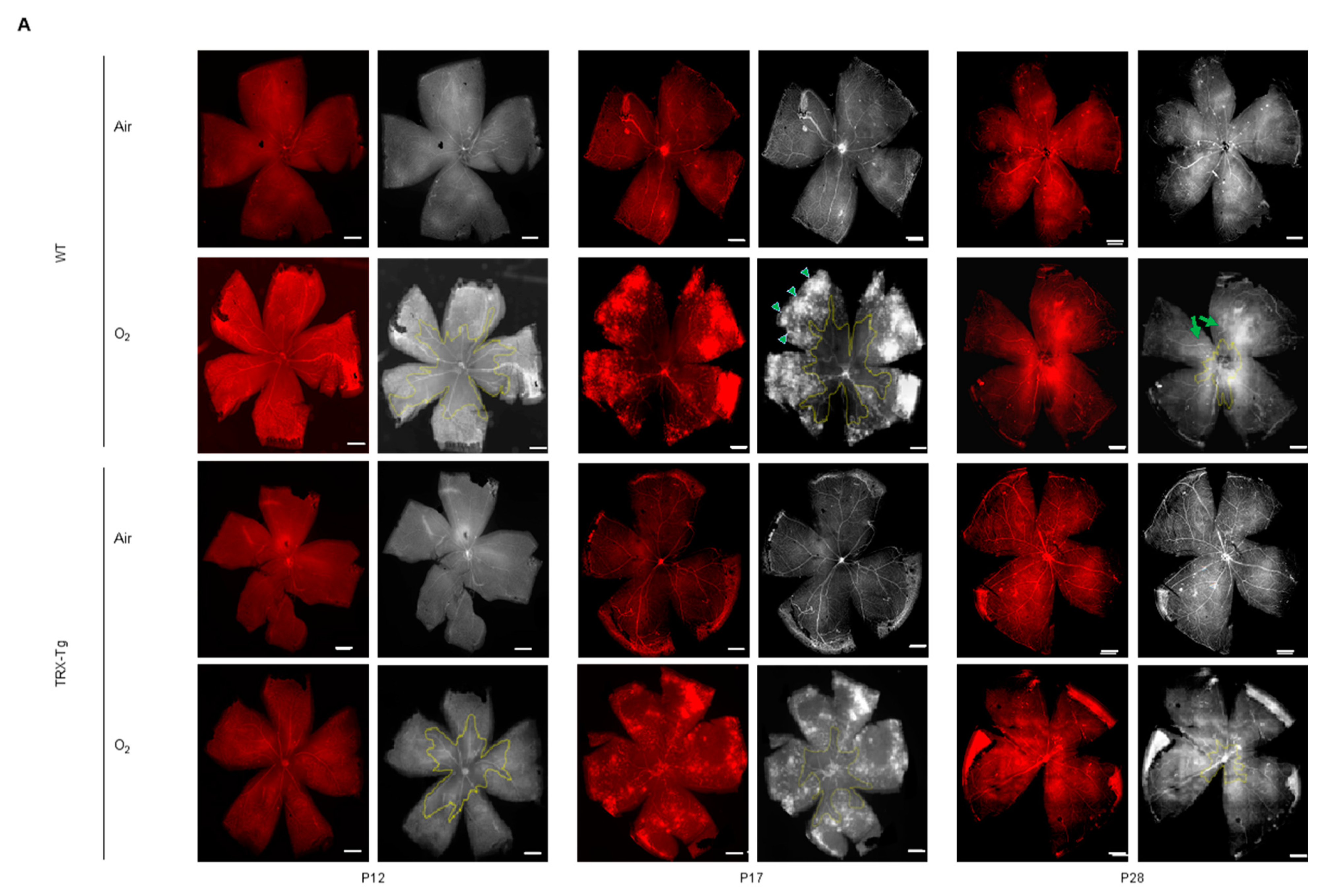 Antioxidants 11 00899 g002a