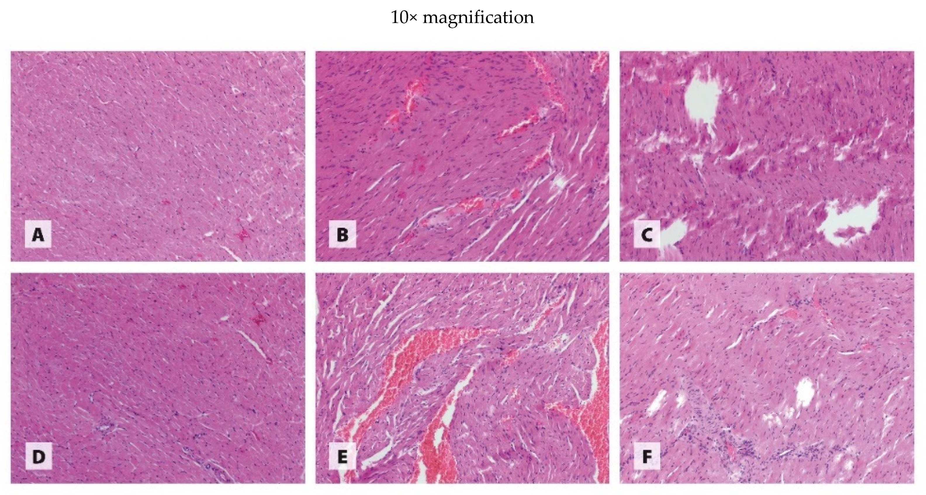 Antioxidants 11 00910 g001b