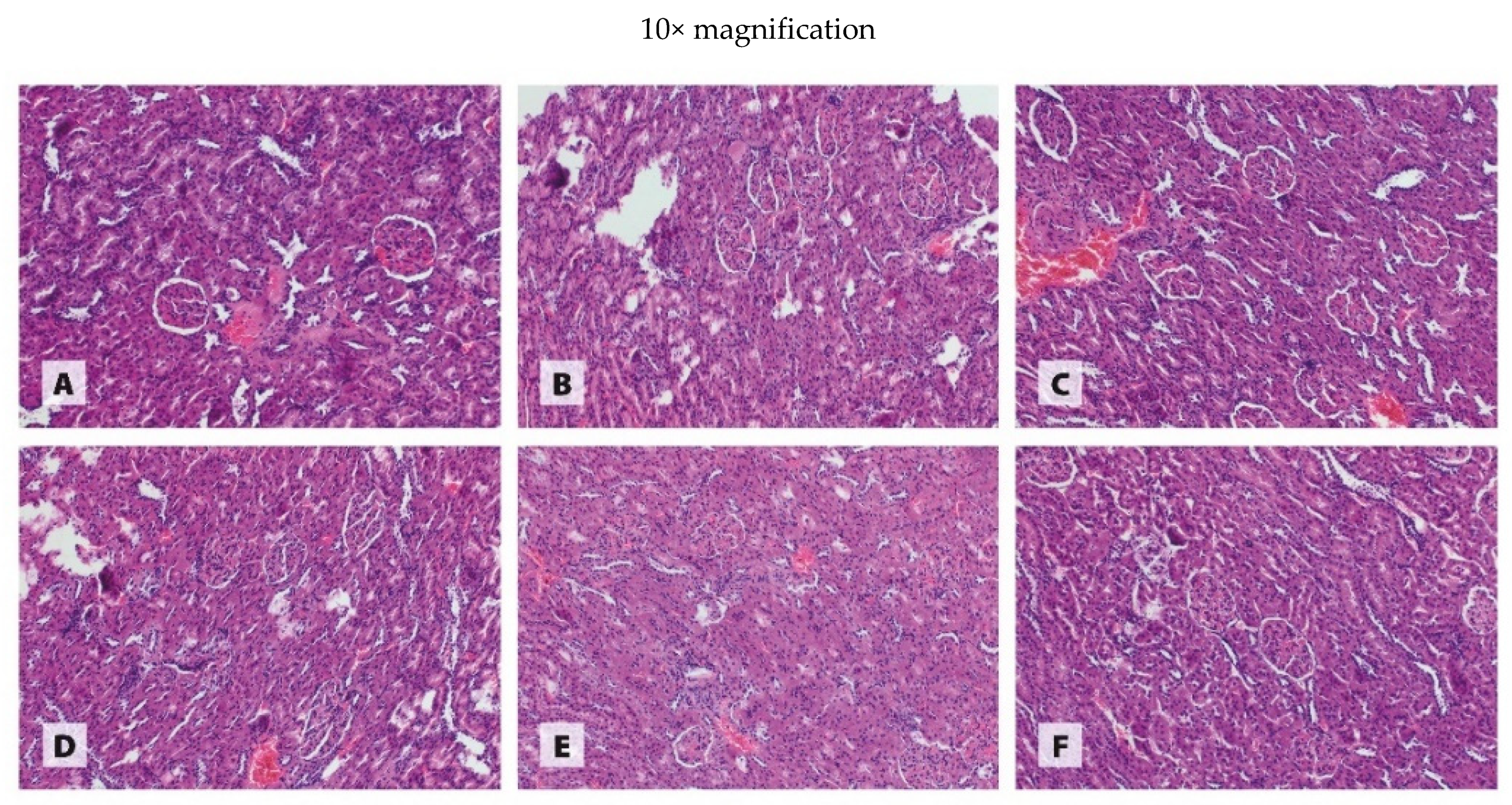 Antioxidants 11 00910 g004b