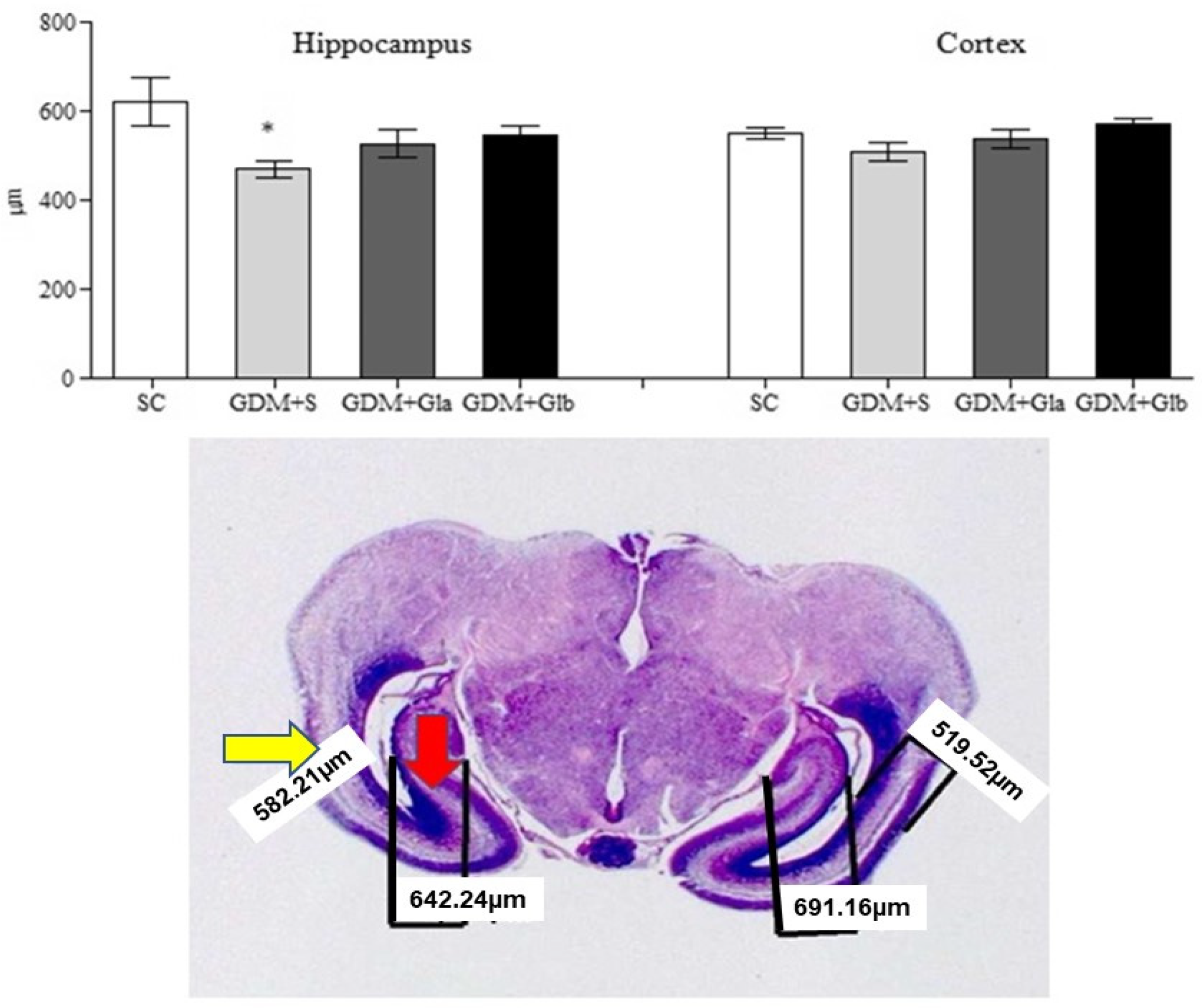 Antioxidants 11 01035 g006