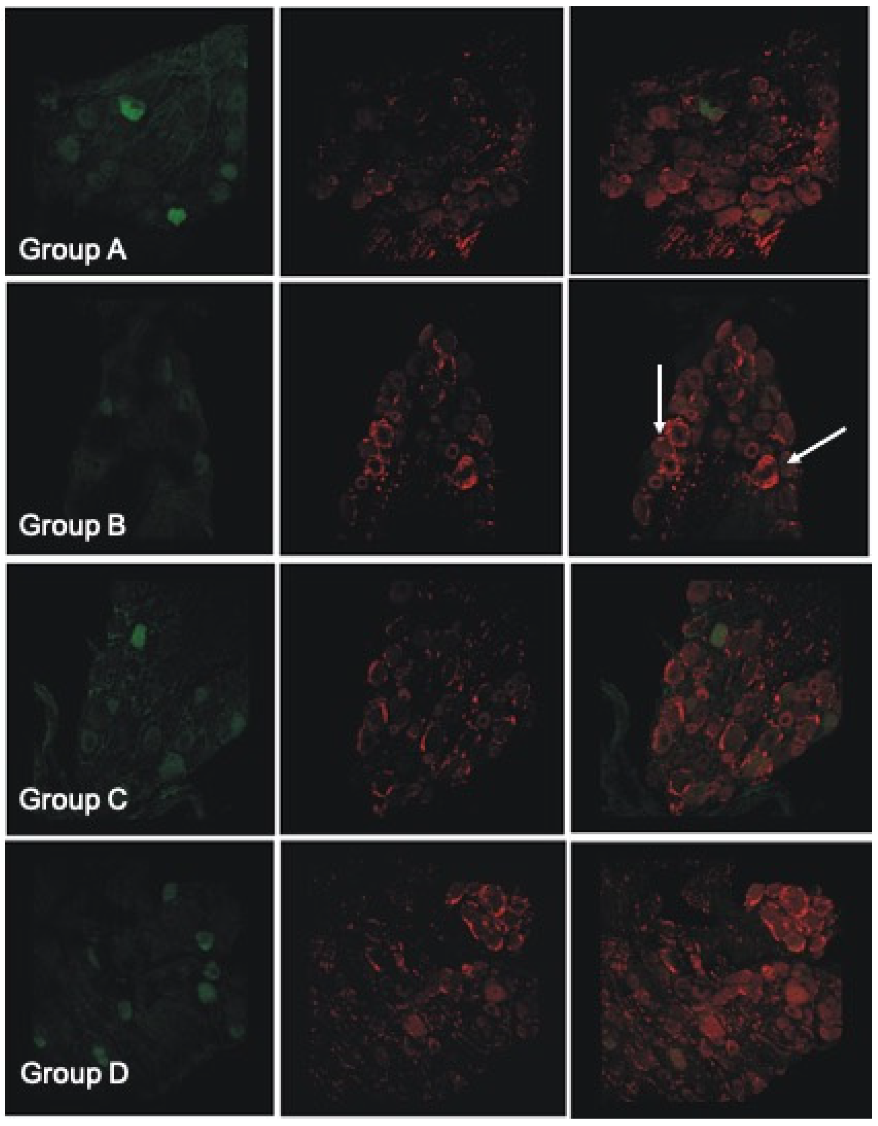 Antioxidants 11 01062 g006