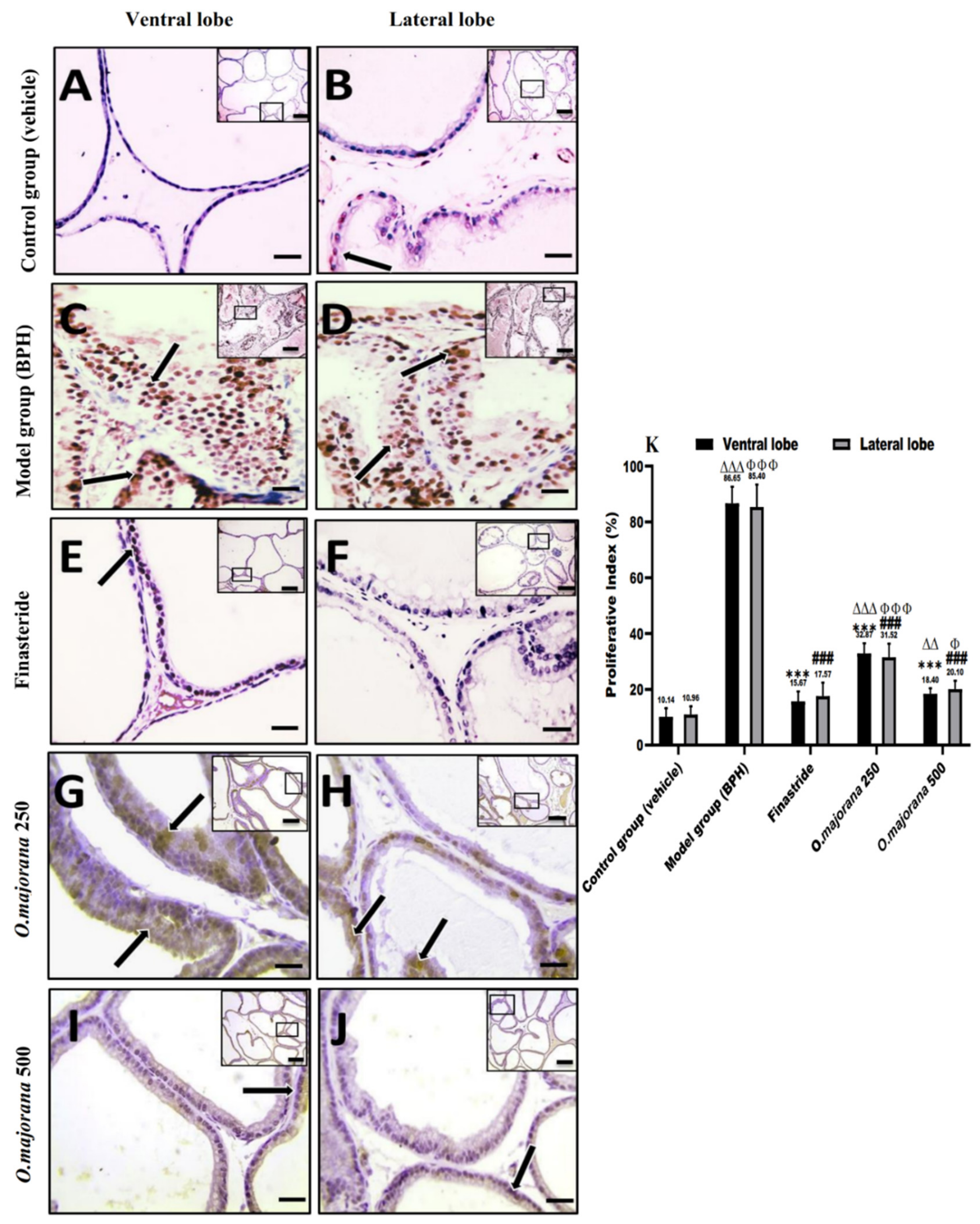 Antioxidants 11 01149 g011 Antioxidants 11 01149 g011