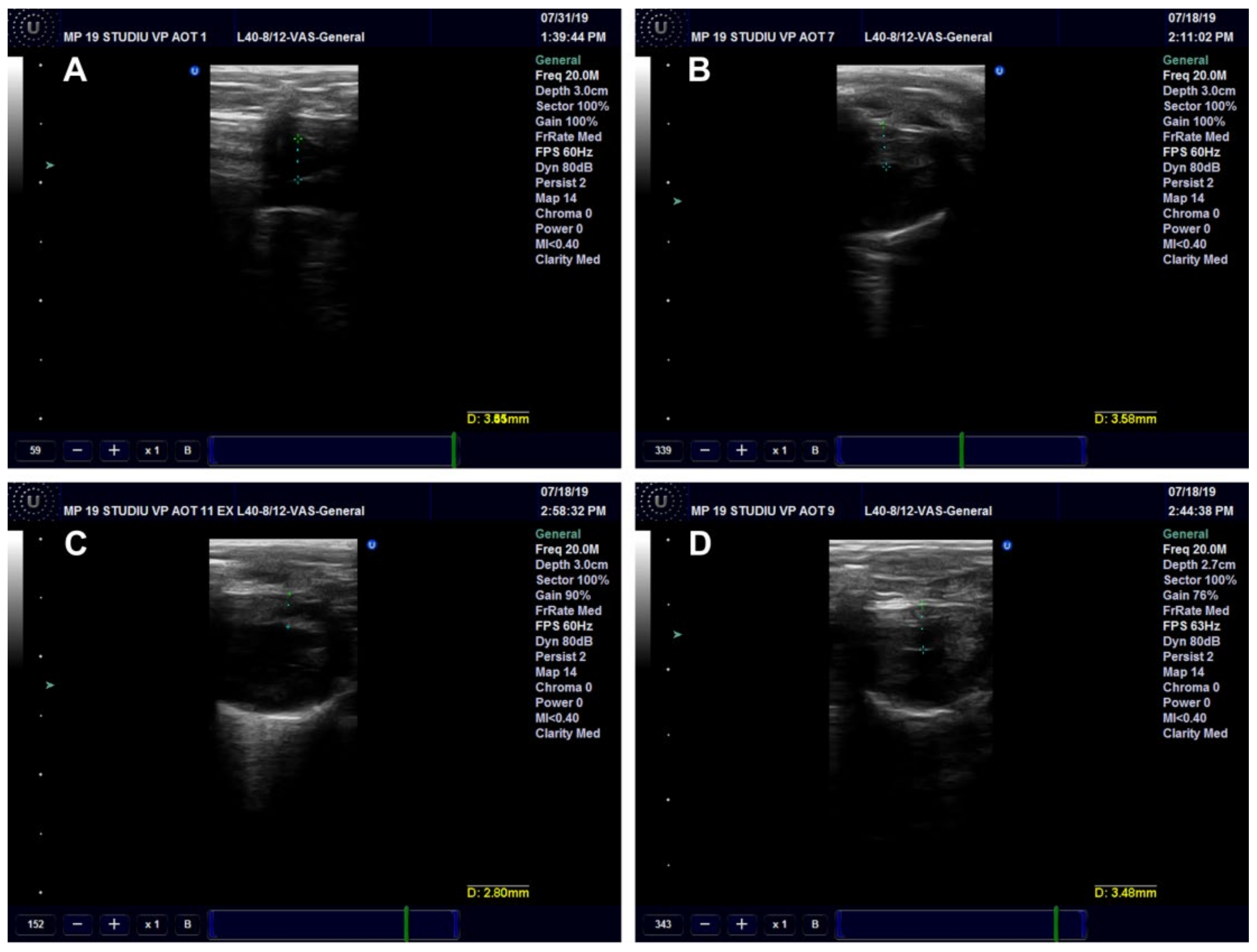 Antioxidants 11 01343 g013