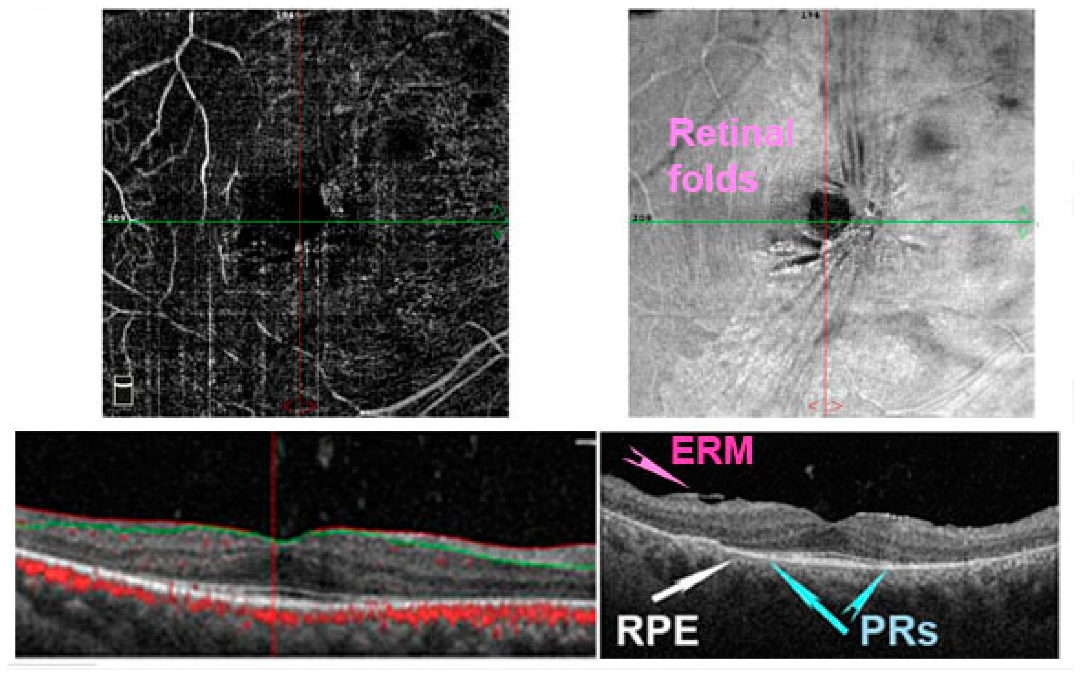 Antioxidants 11 01790 g005