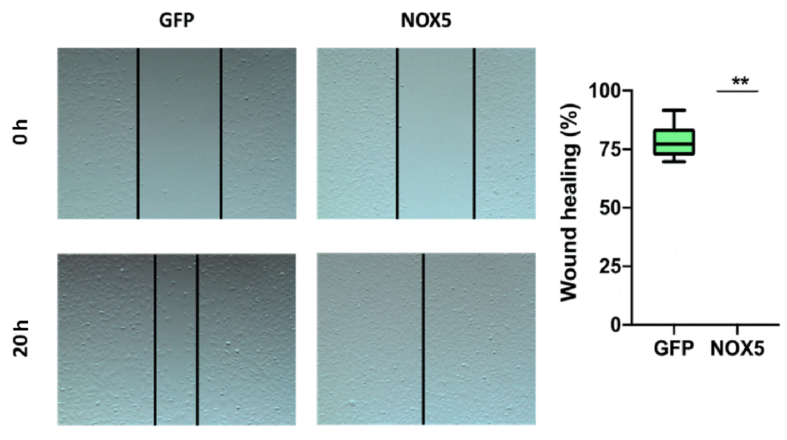Antioxidants 11 02147 g011