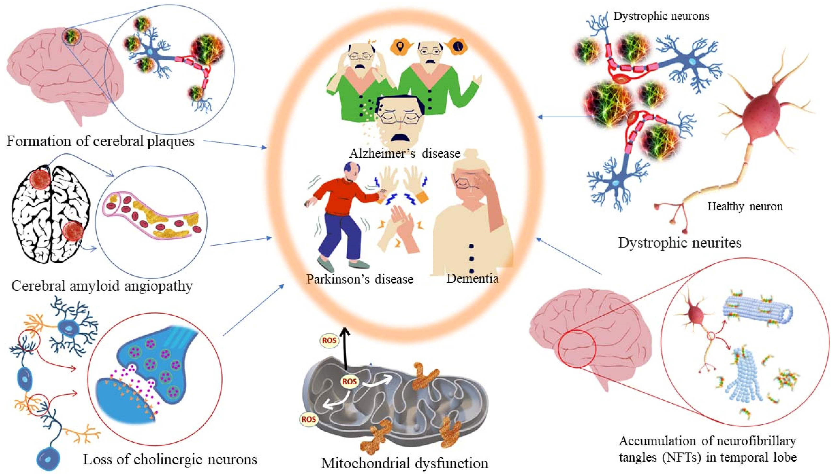 Antioxidants 11 02374 g012