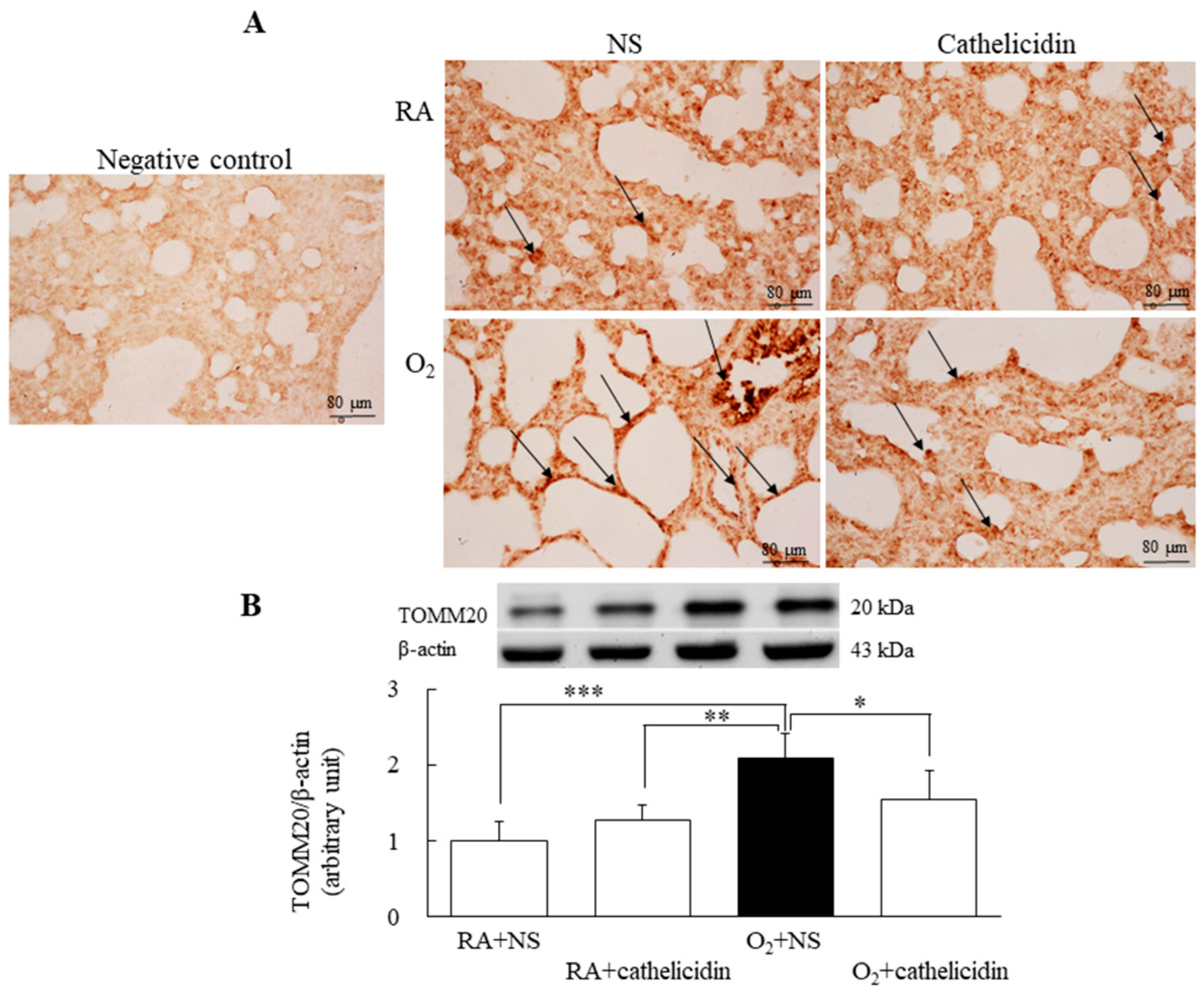 Antioxidants 11 02405 g005