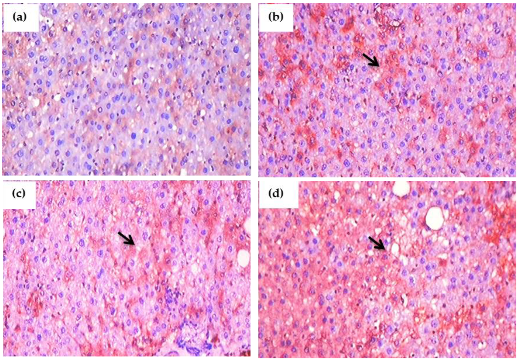 Antioxidants 11 02436 g011