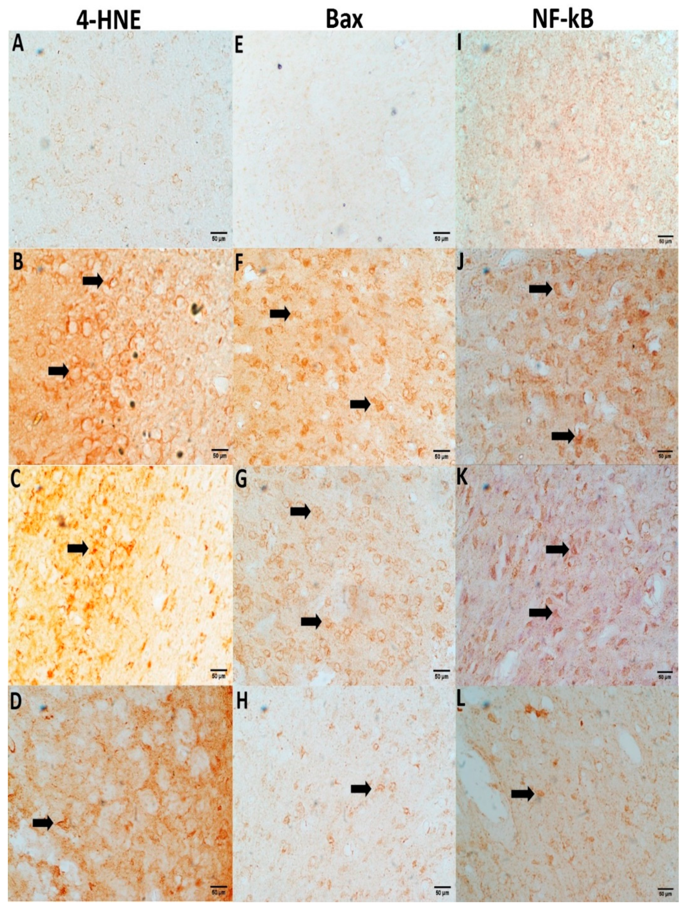Antioxidants 12 00644 g005
