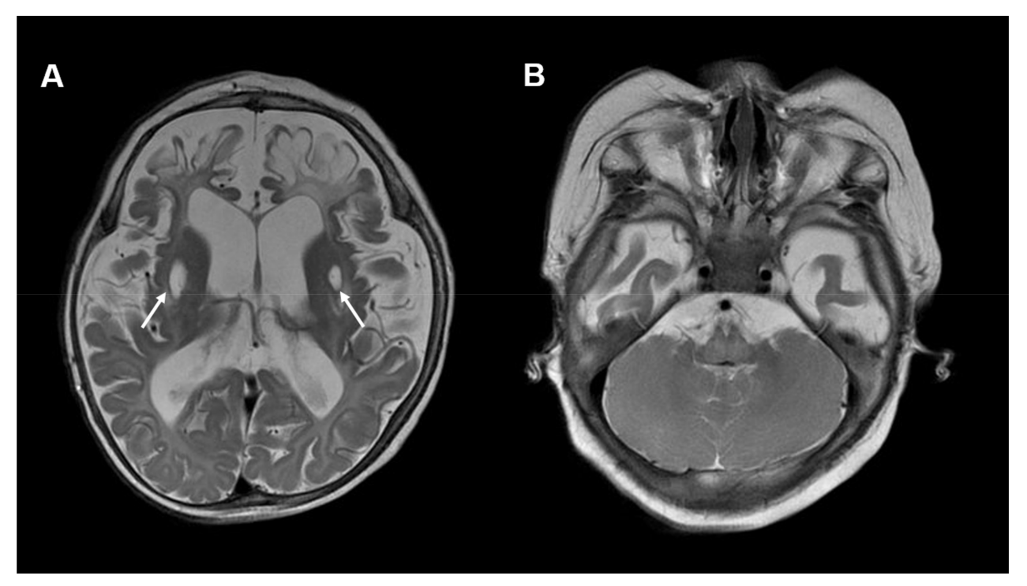 Antioxidants 12 00718 g004