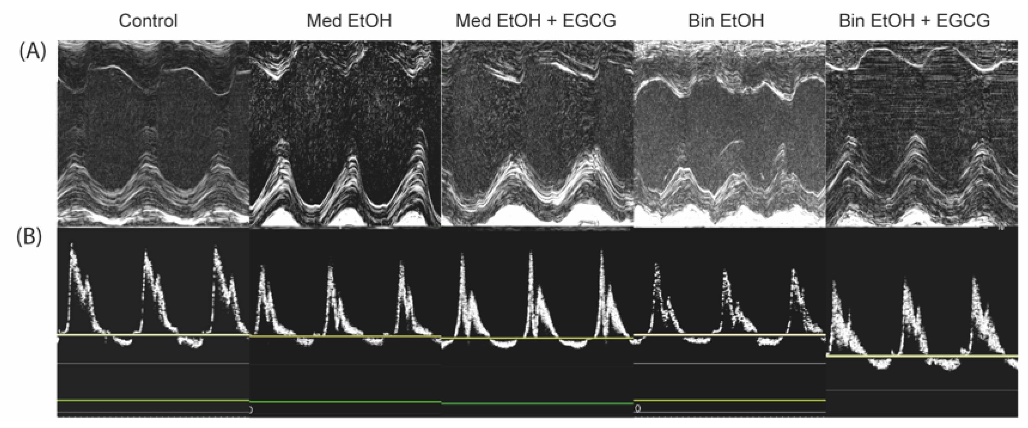Antioxidants 12 01067 g007 Antioxidants 12 01067 g007