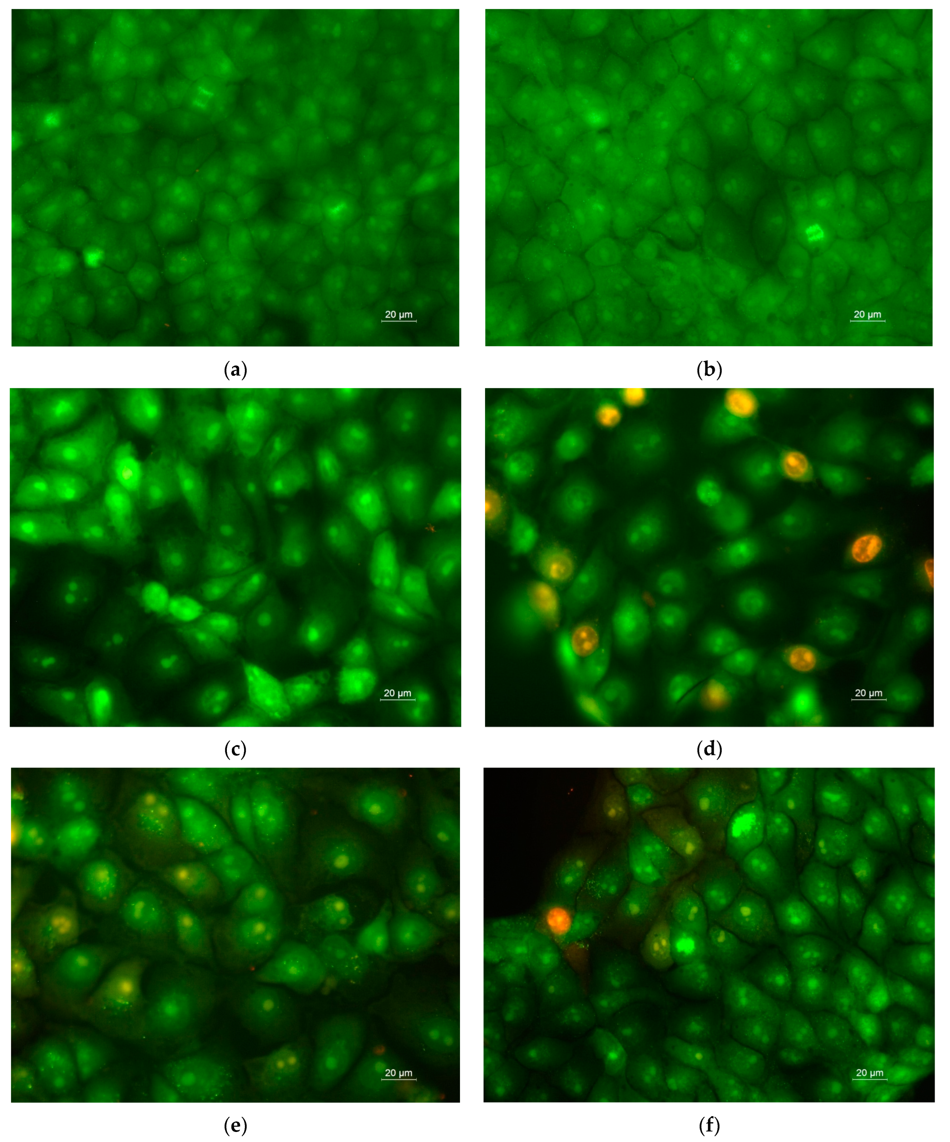 Antioxidants 12 01243 g011