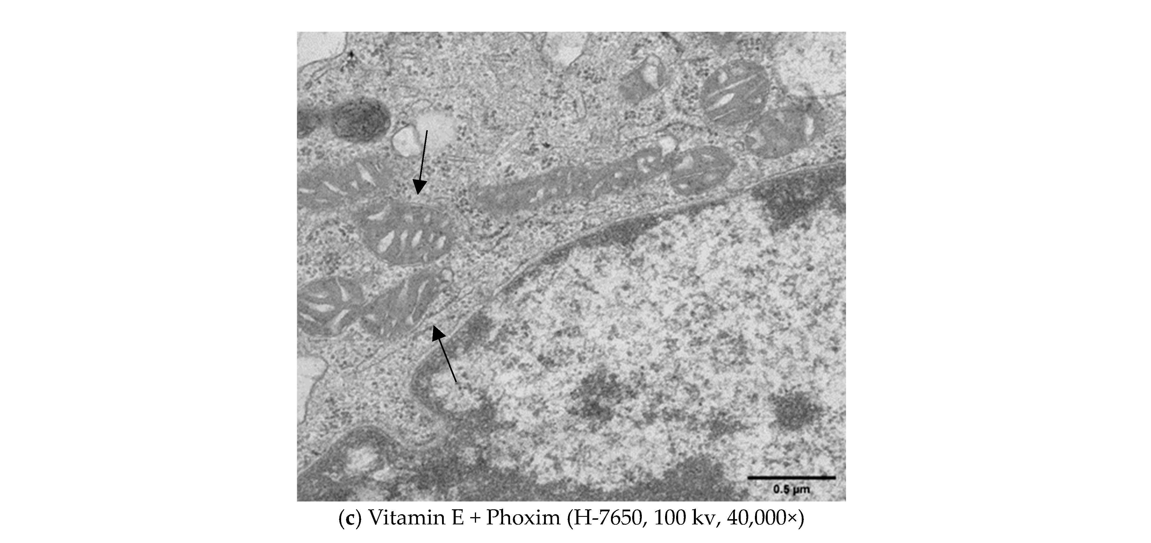 Antioxidants 12 02000 g003b