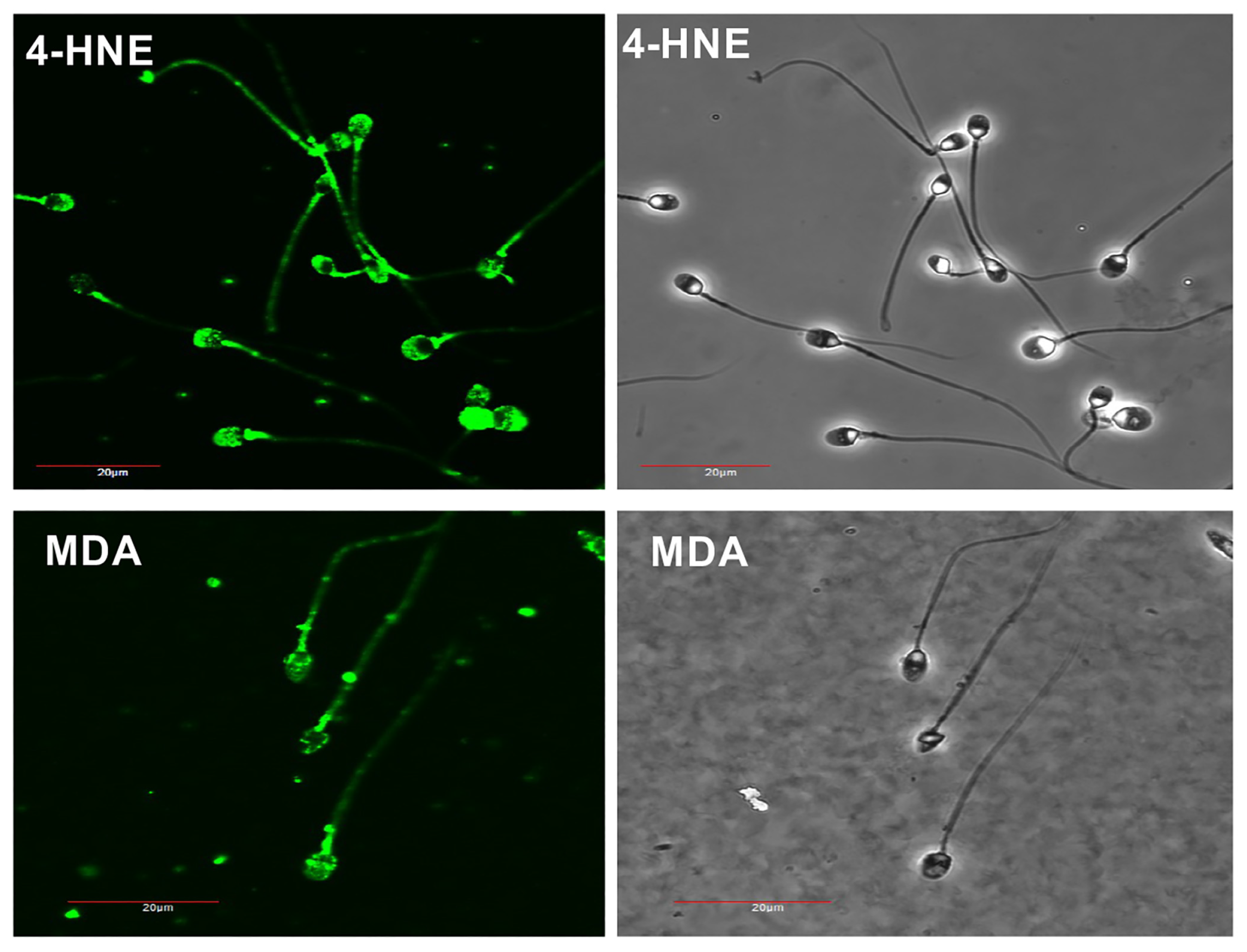 Antioxidants 13 00247 g005
