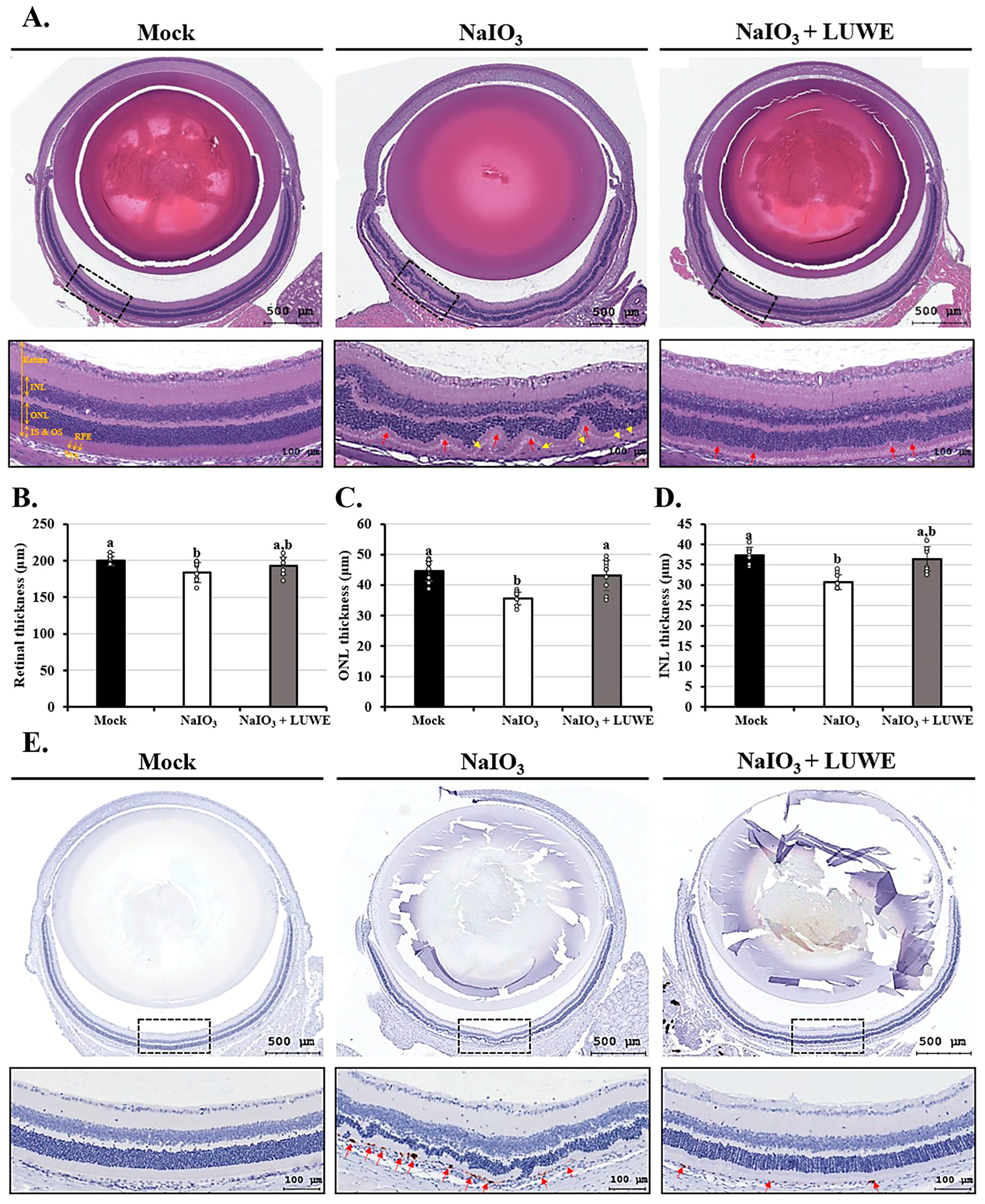 Antioxidants 13 00538 g002