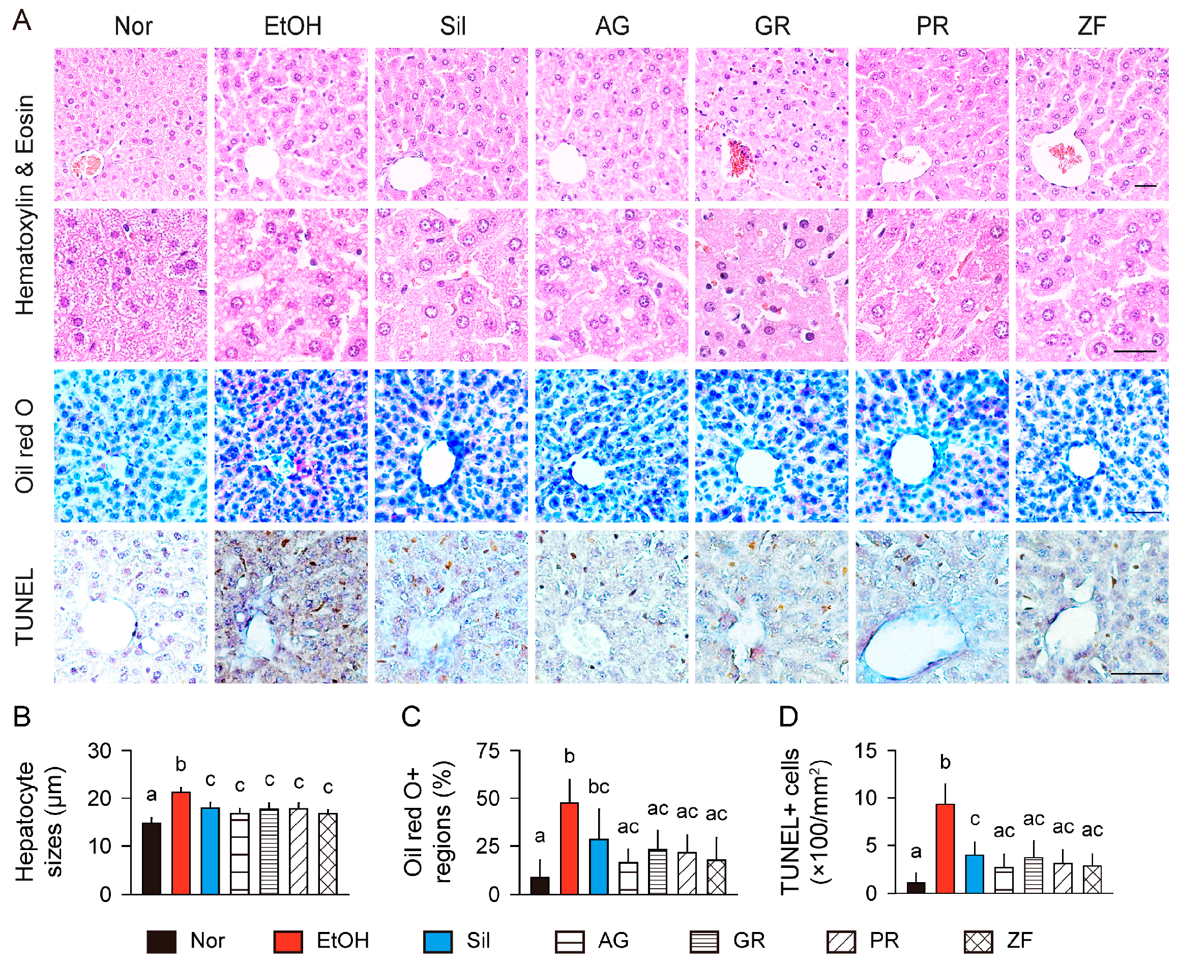 Antioxidants 13 01137 g006