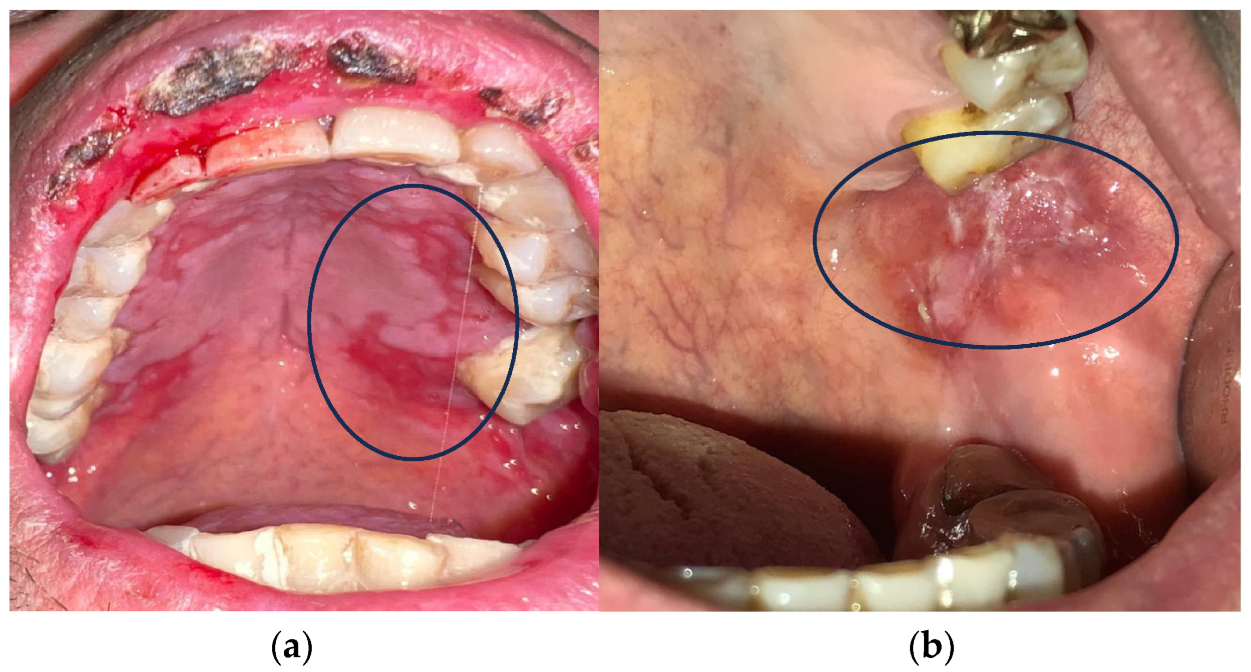 Antioxidants 13 01160 g001