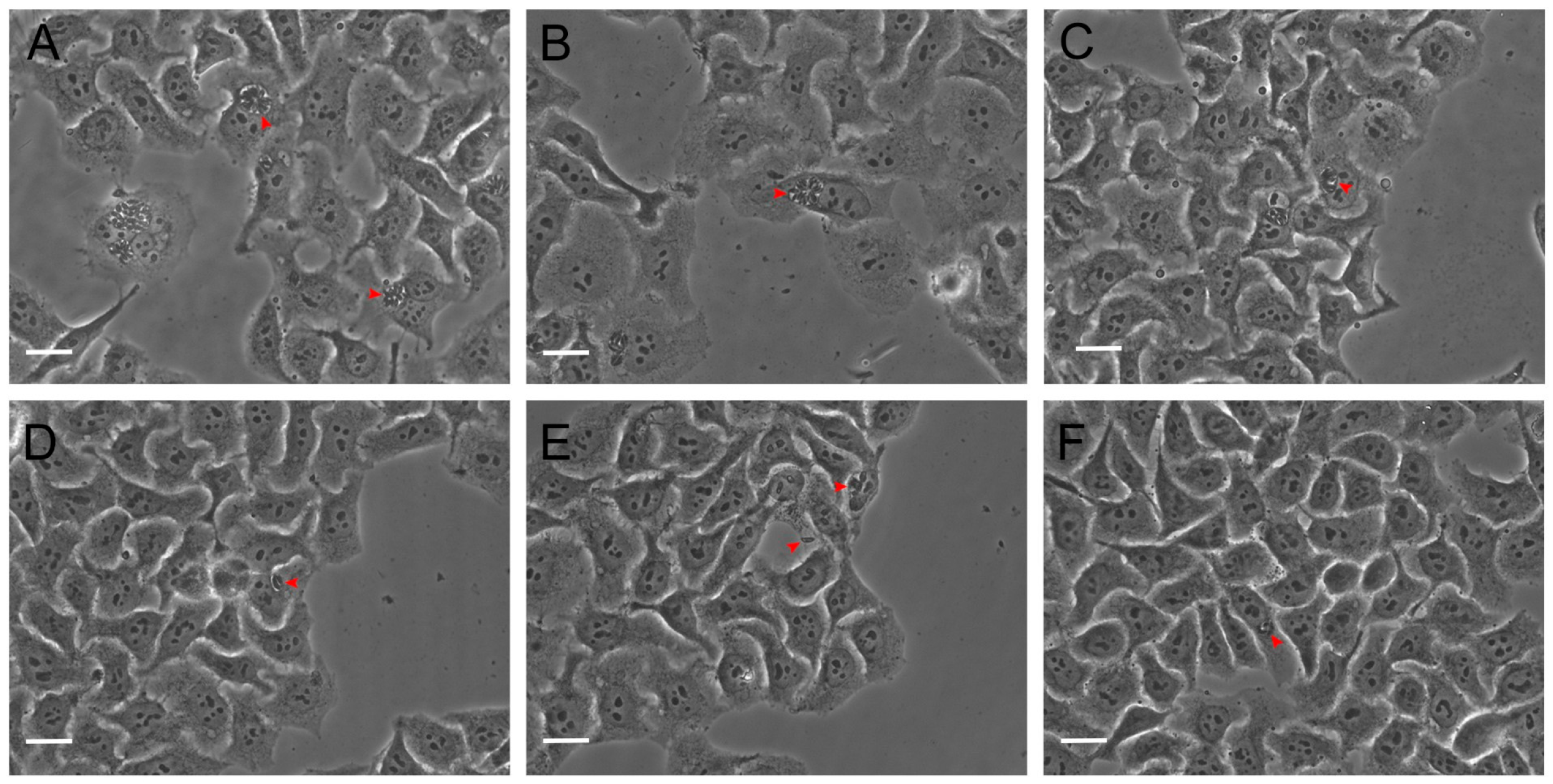 Antioxidants 14 00342 g006