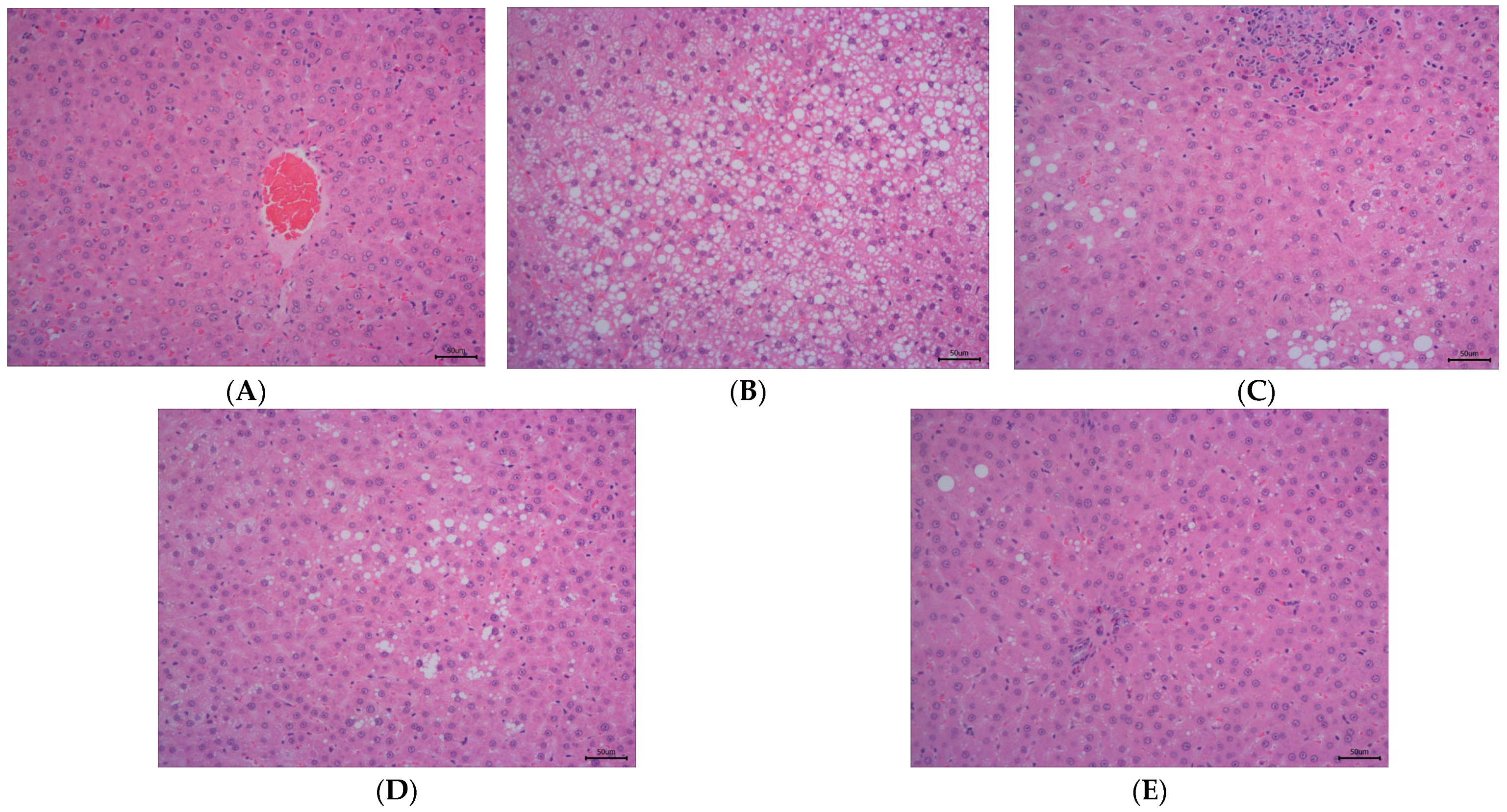 Antioxidants 14 00432 g002a