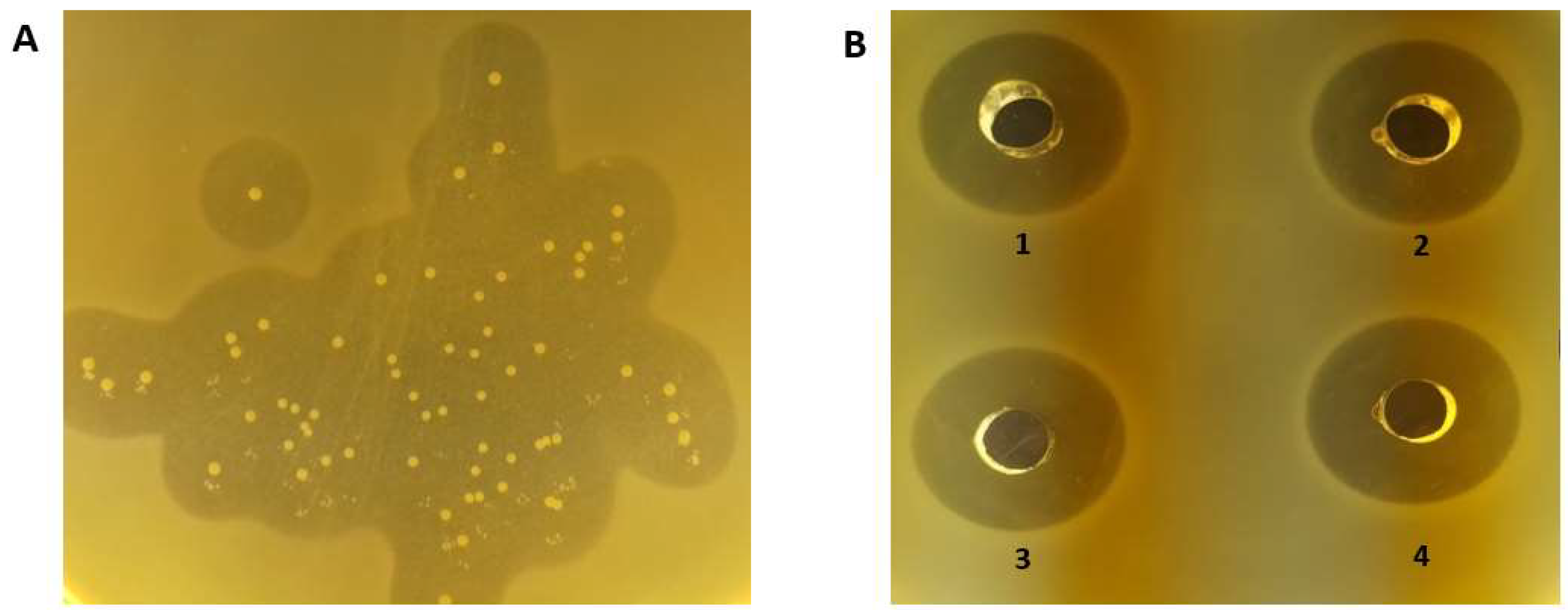Applmicrobiol 05 00011 g002