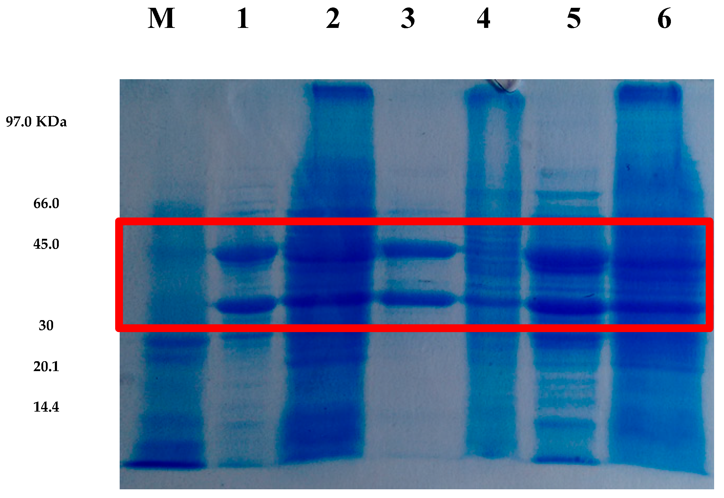 Applmicrobiol 05 00075 g004