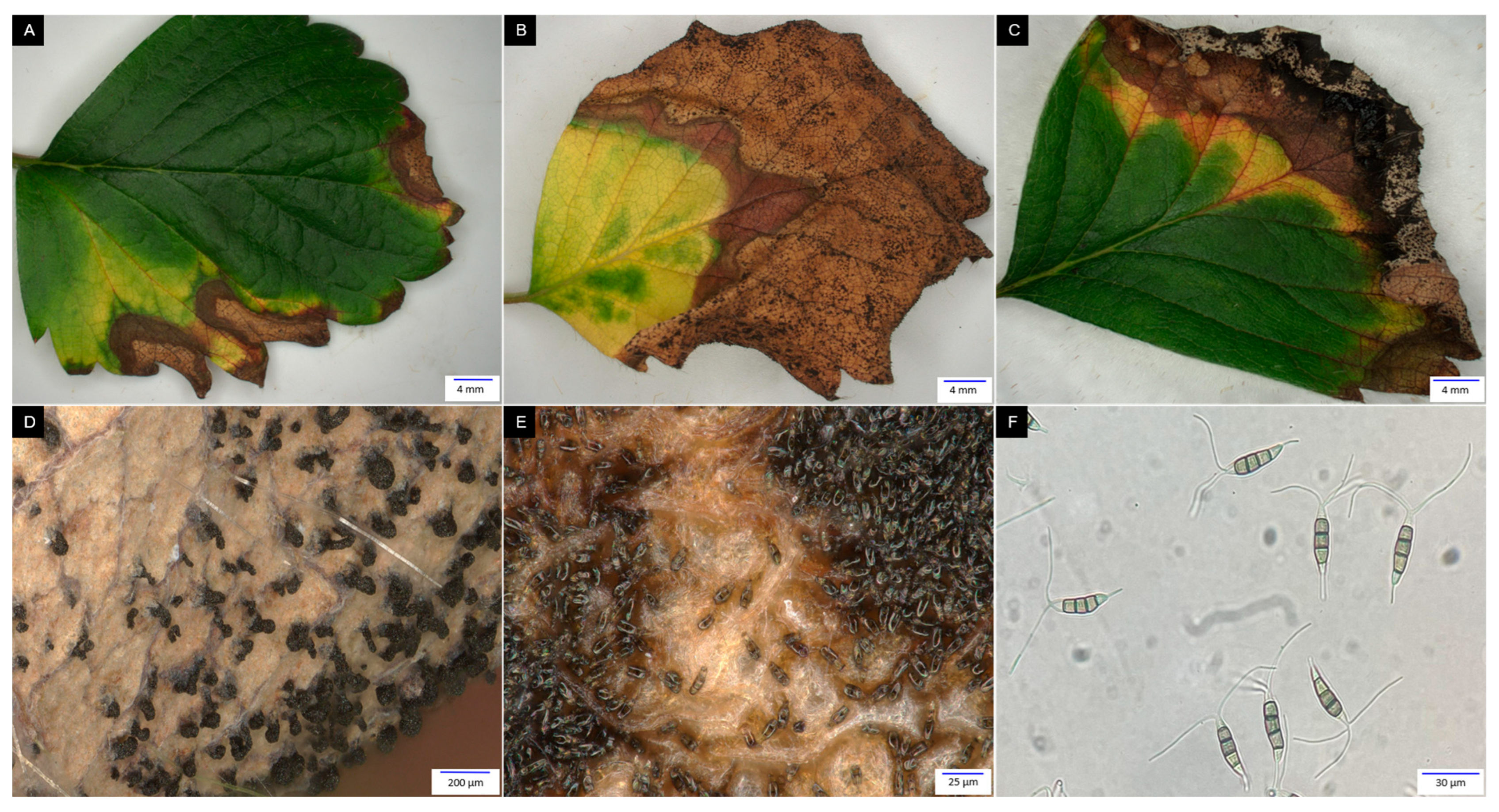 Applmicrobiol 06 00046 g004 Applmicrobiol 06 00046 g004