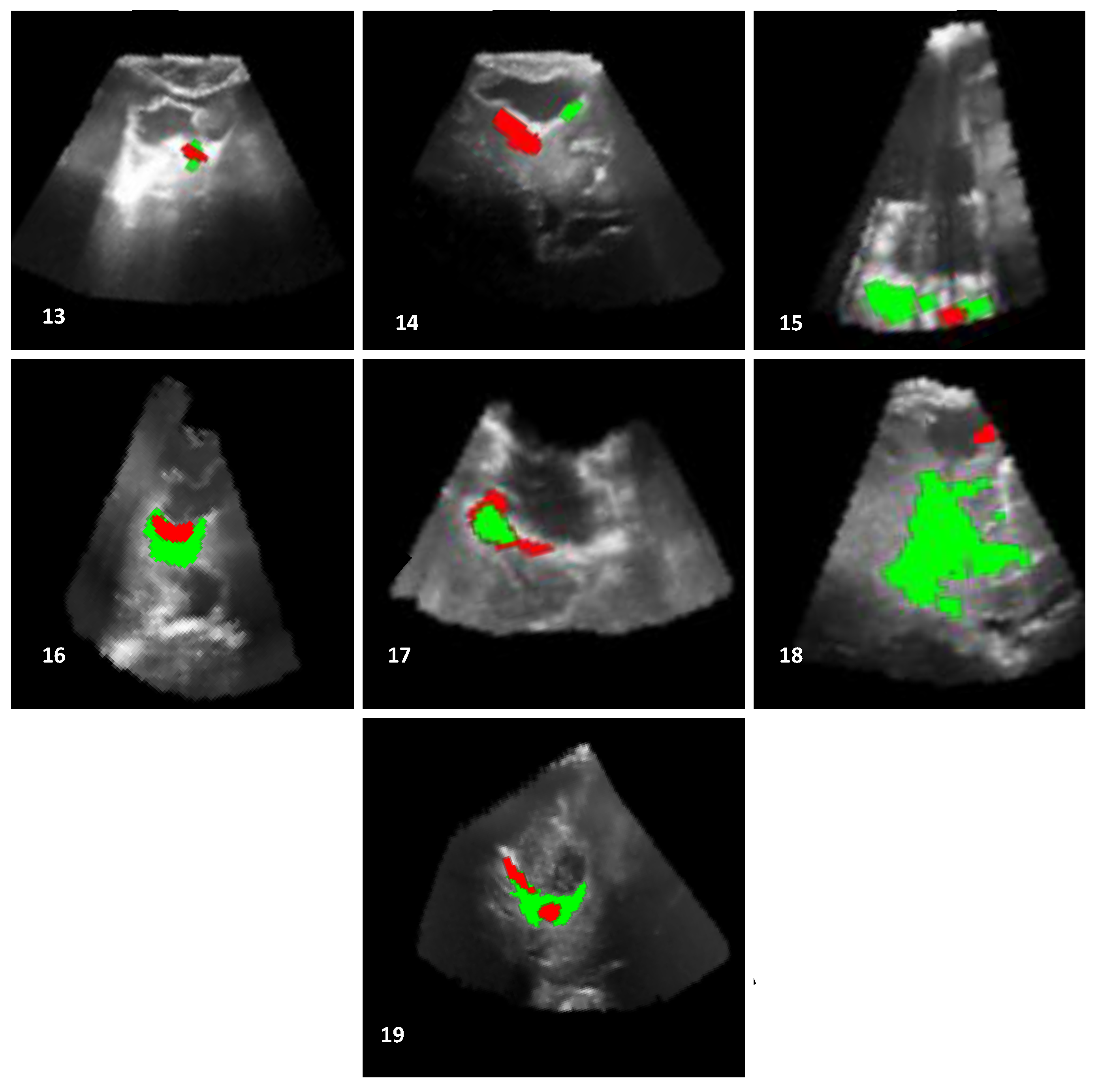 Applsci 07 00415 g009