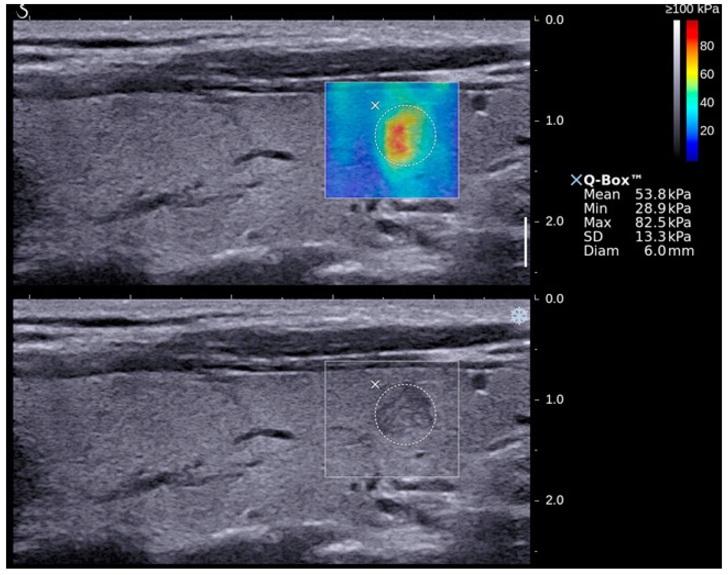 Applsci 07 01103 g004