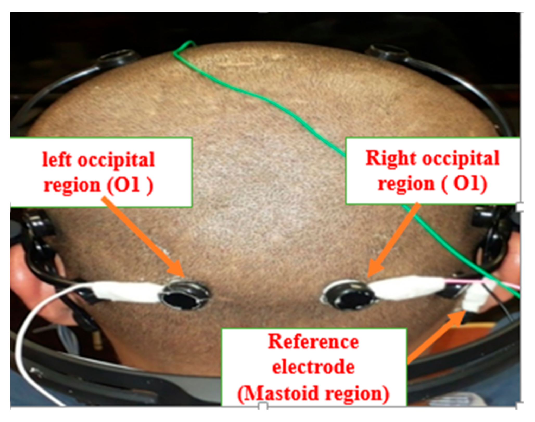 Applsci 07 01153 g002 Applsci 07 01153 g002