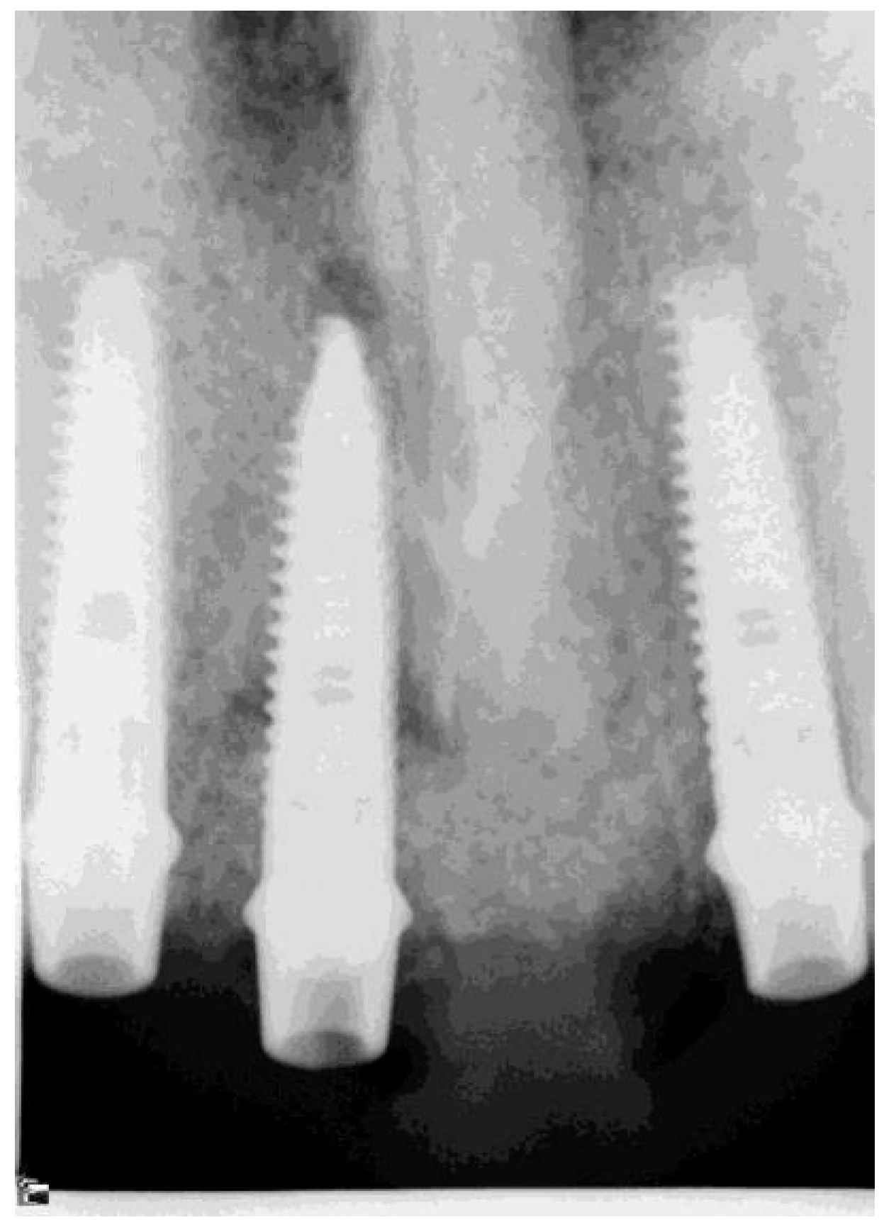 Applsci 08 00377 g002