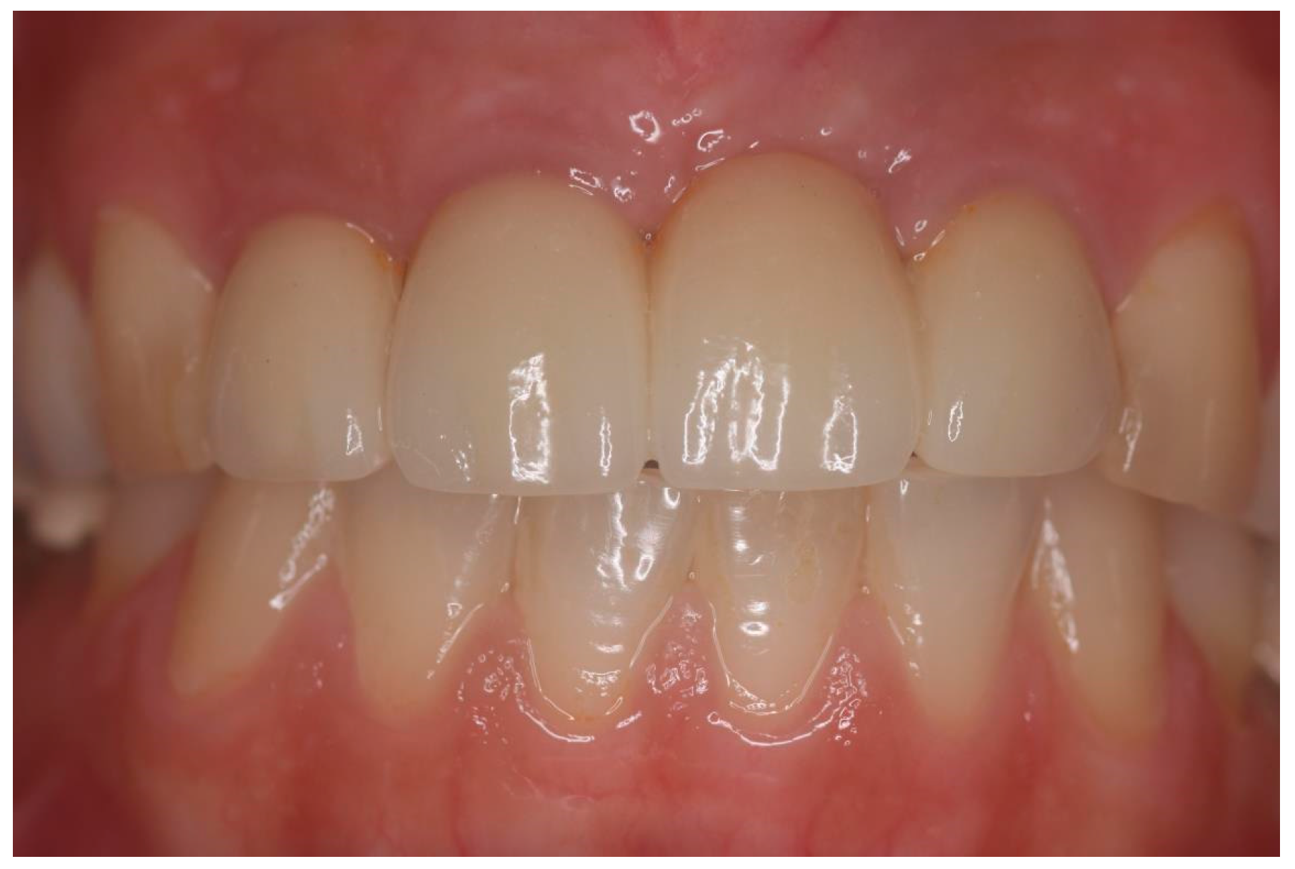 Applsci 08 00377 g005