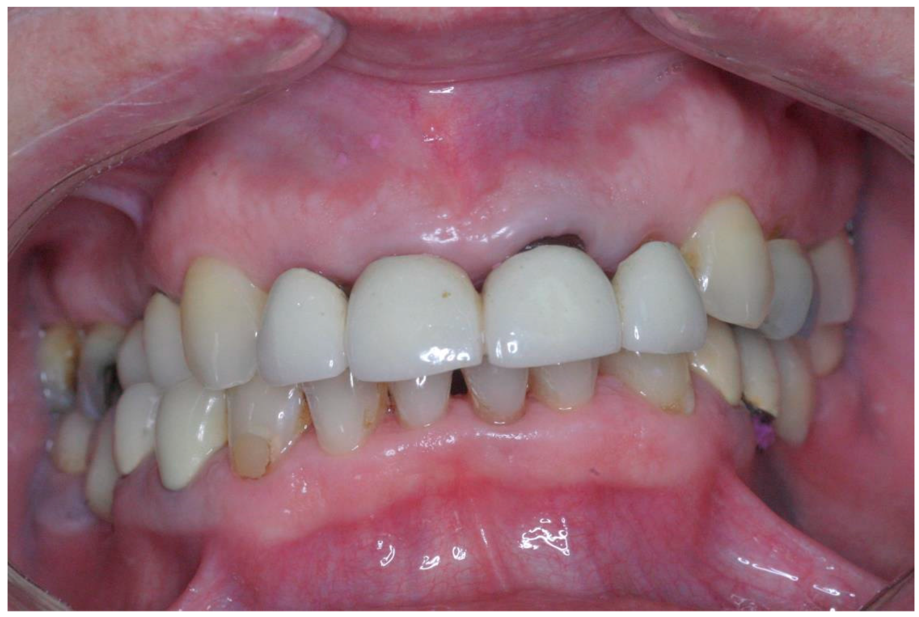 Applsci 08 00377 g006