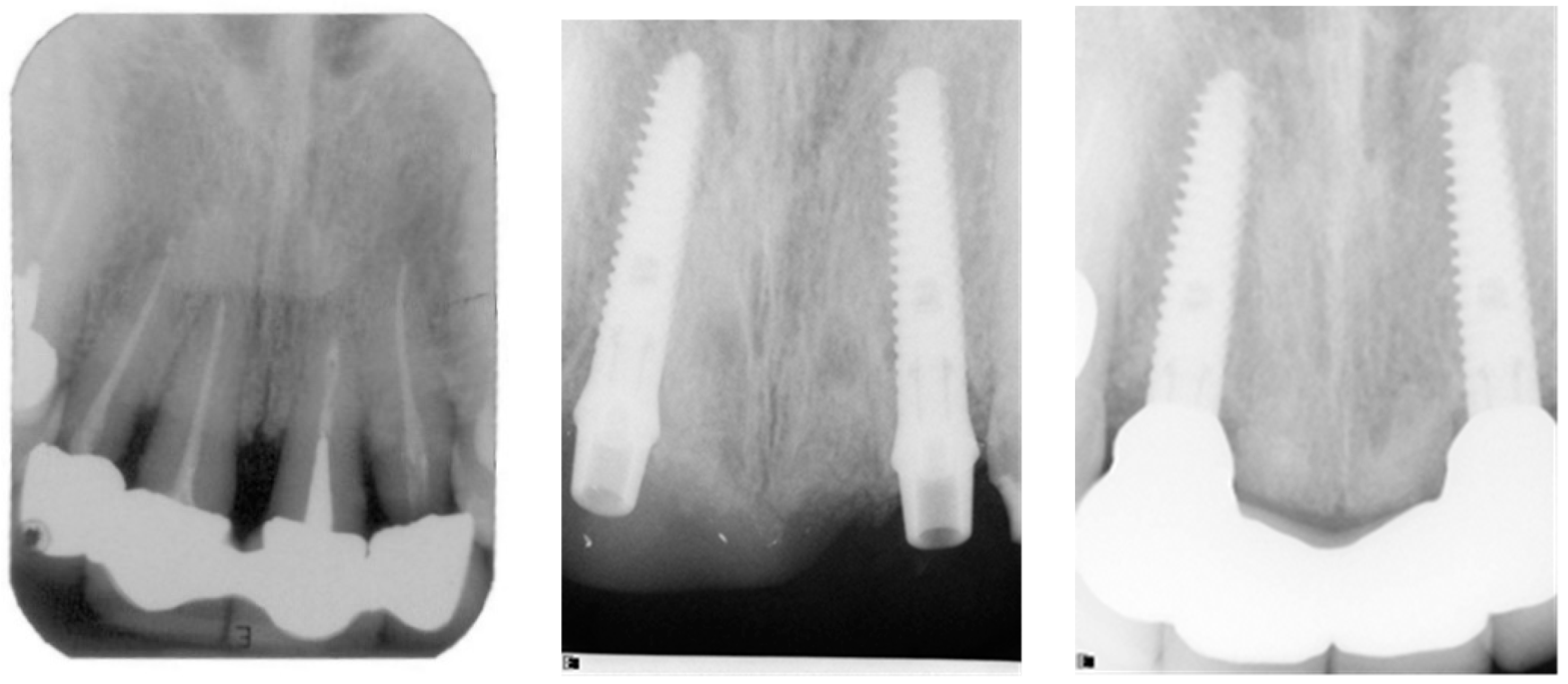 Applsci 08 00377 g009