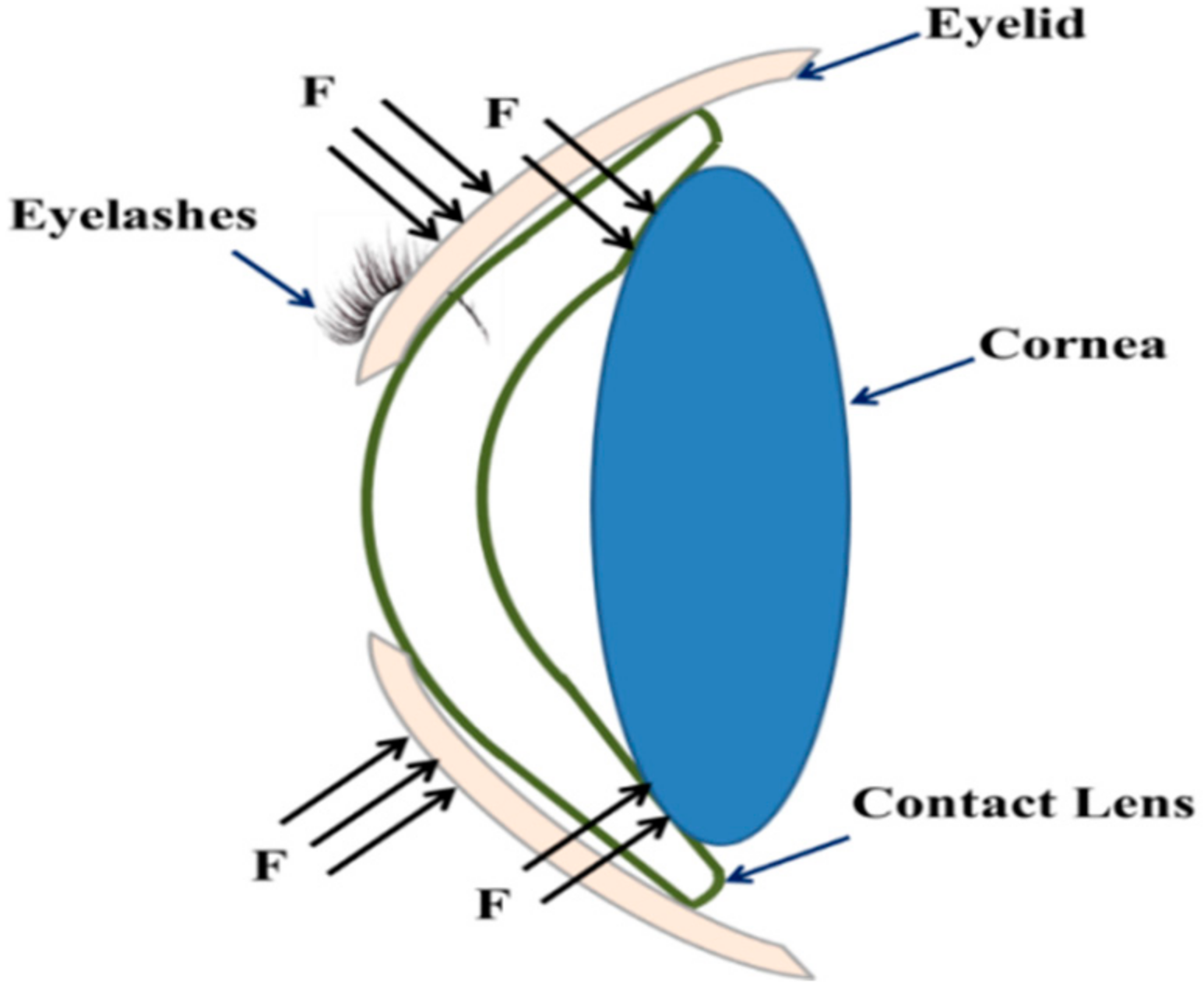 Applsci 08 00855 g003