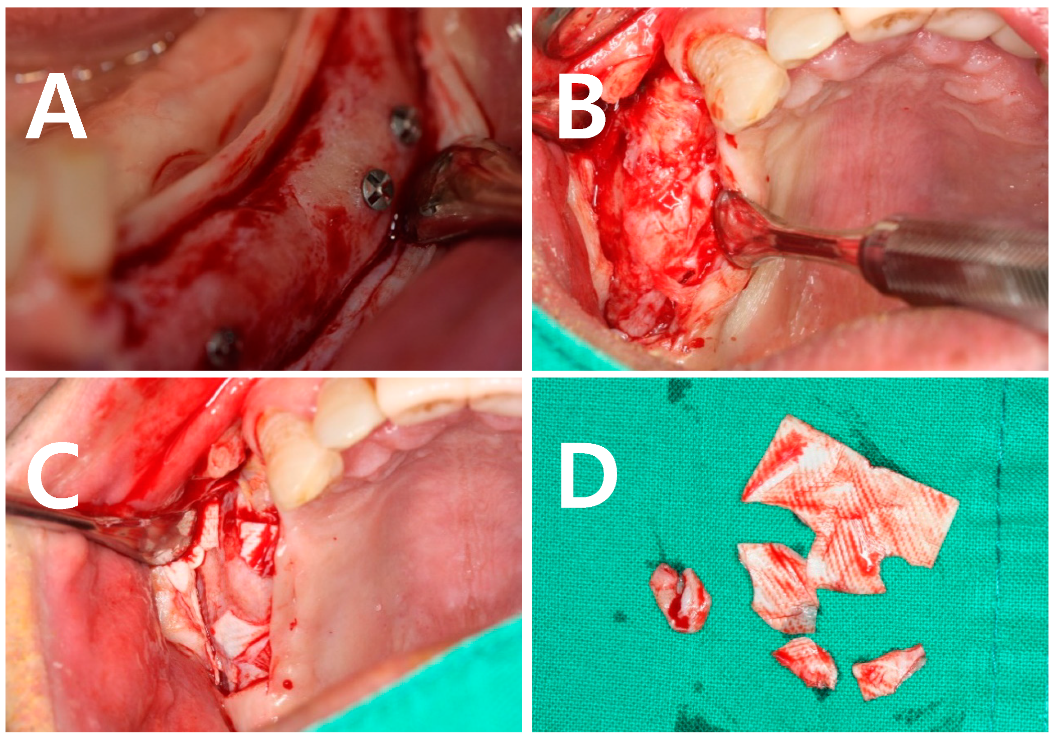 Applsci 08 02048 g004 Applsci 08 02048 g004
