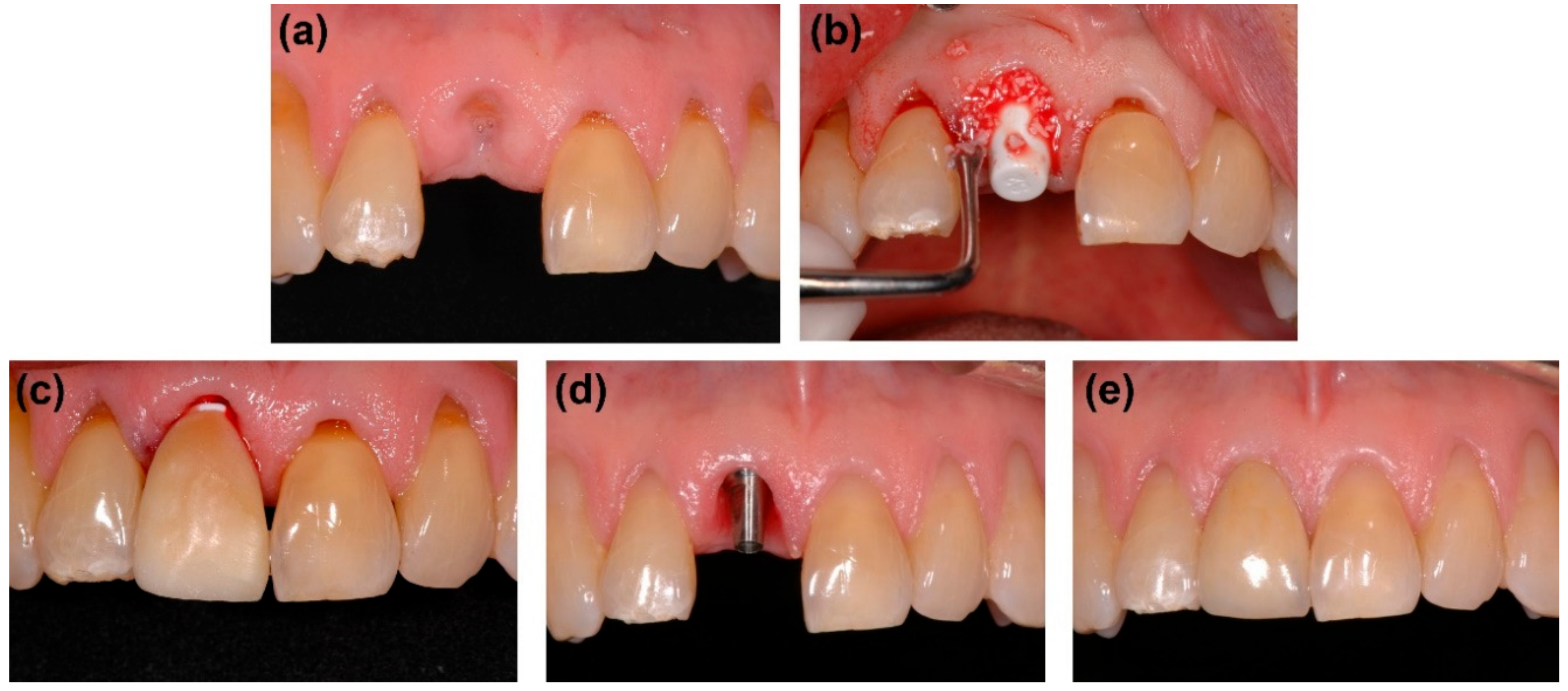 Applsci 08 02261 g002