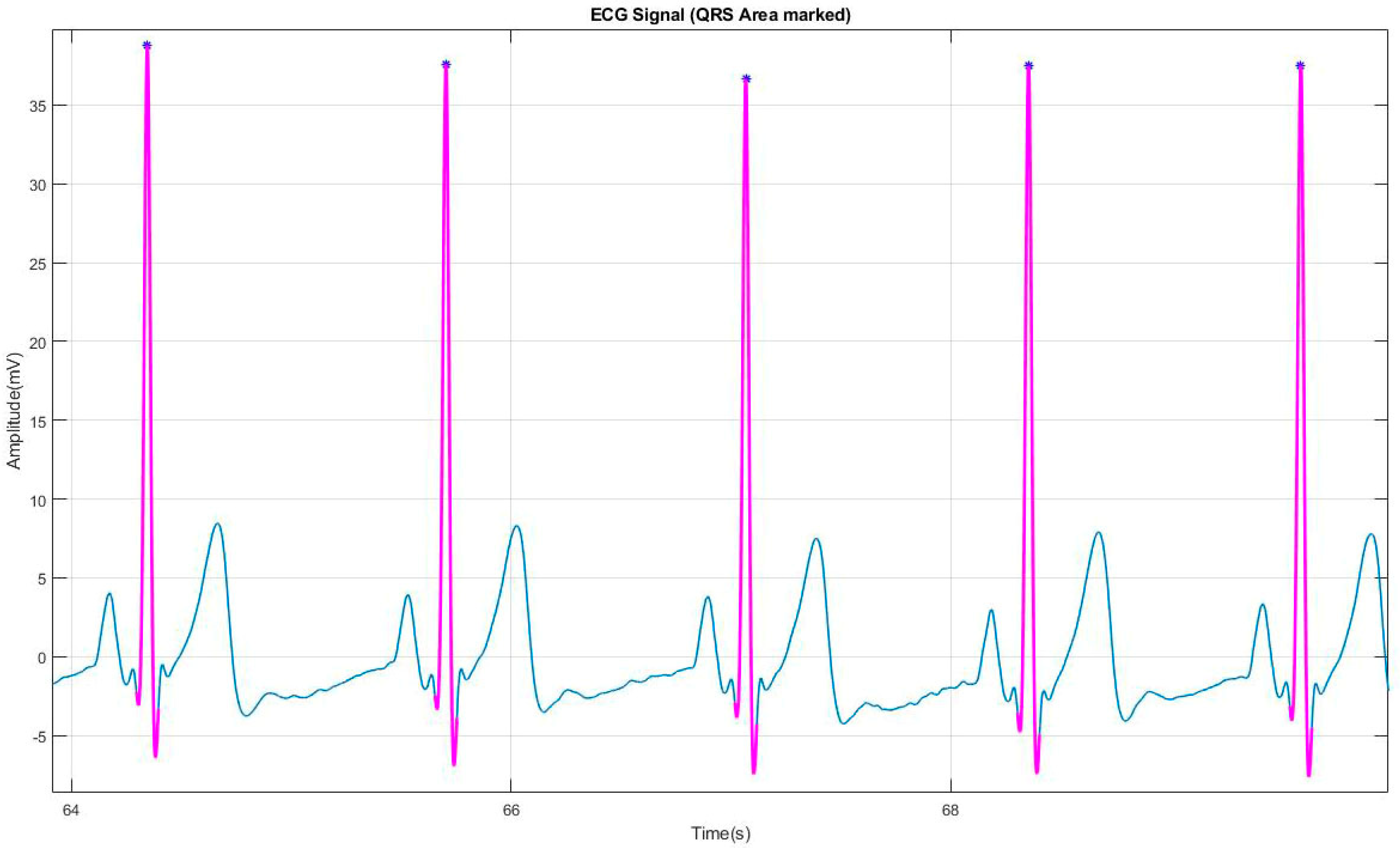 Applsci 09 00702 g004