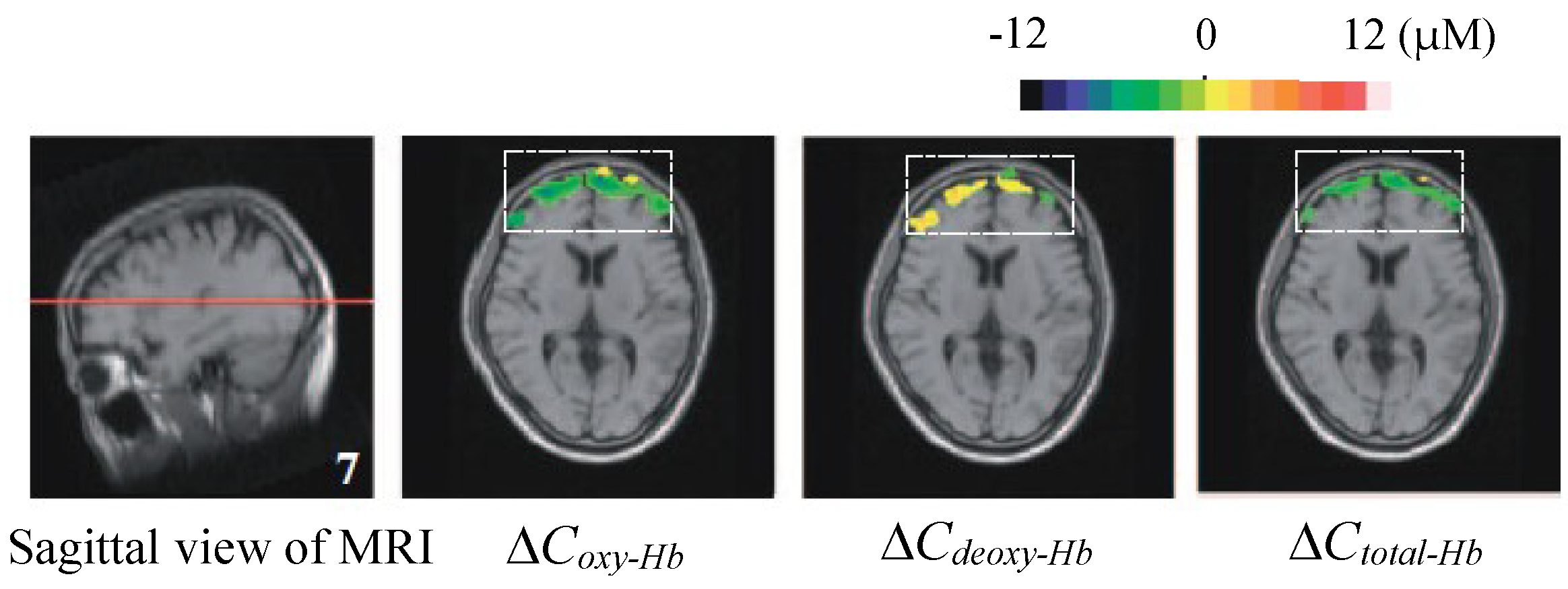 Applsci 09 01127 g017
