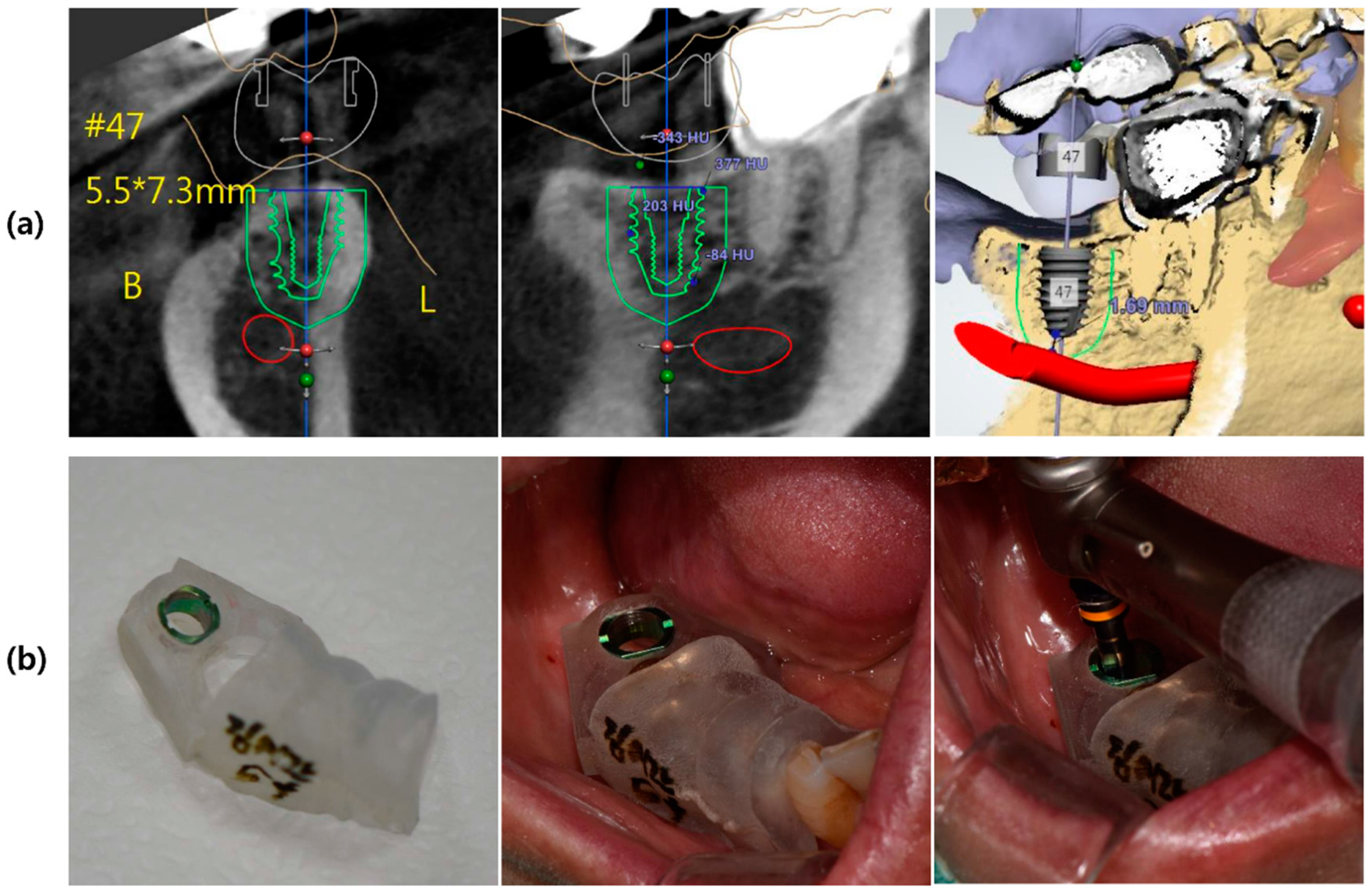 Applsci 09 01282 g002 Applsci 09 01282 g002