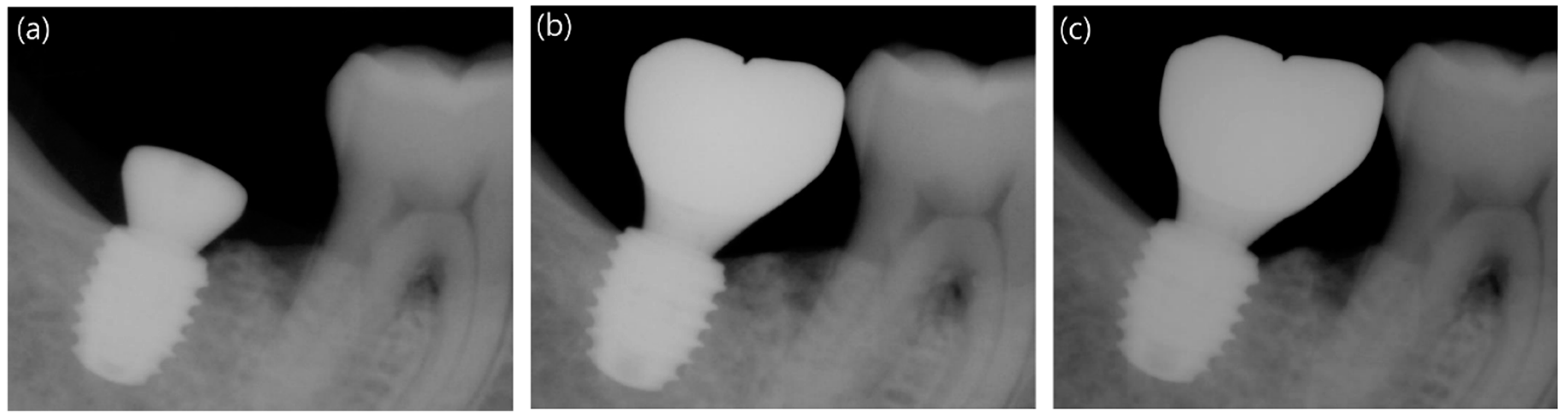 Applsci 09 01282 g005 Applsci 09 01282 g005