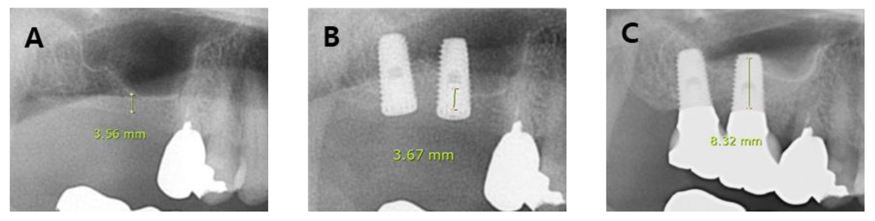 Applsci 09 01514 g004