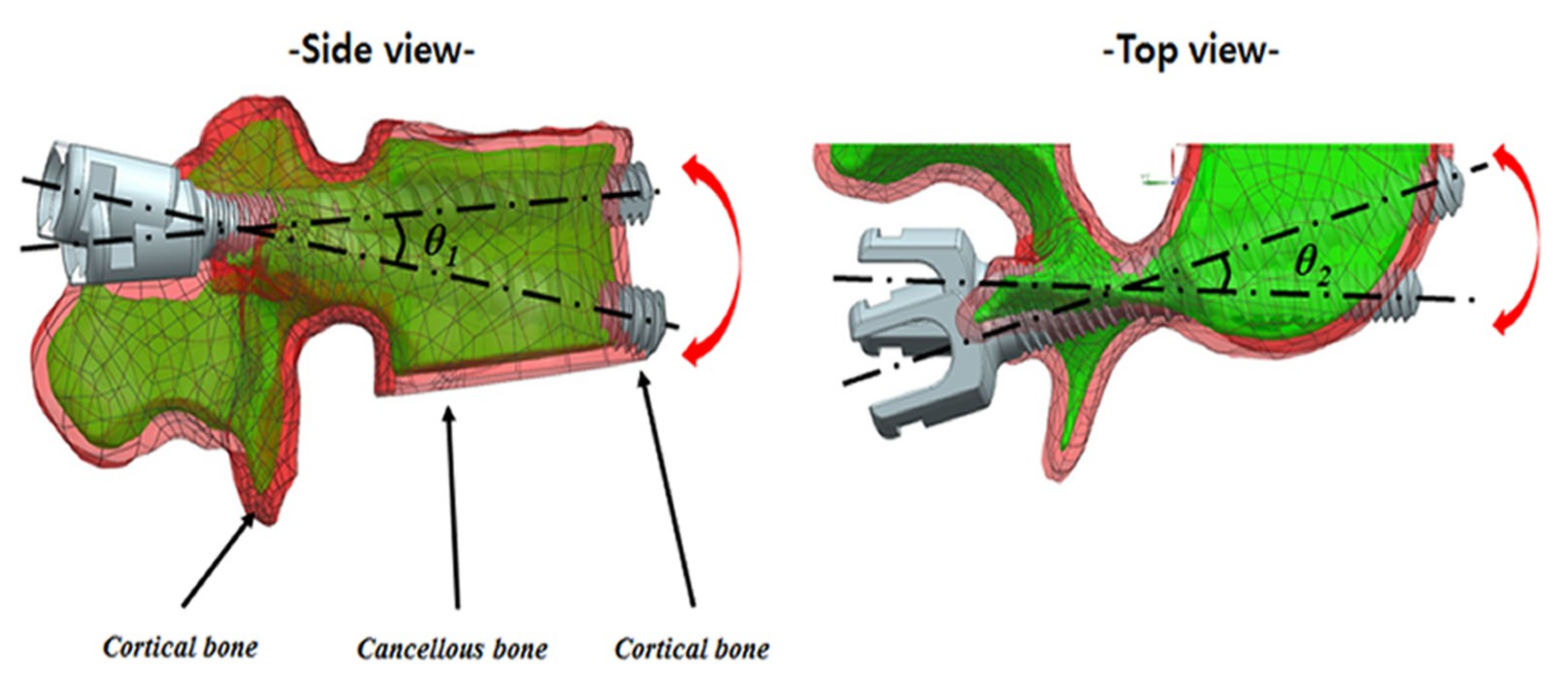 Applsci 09 01525 g003