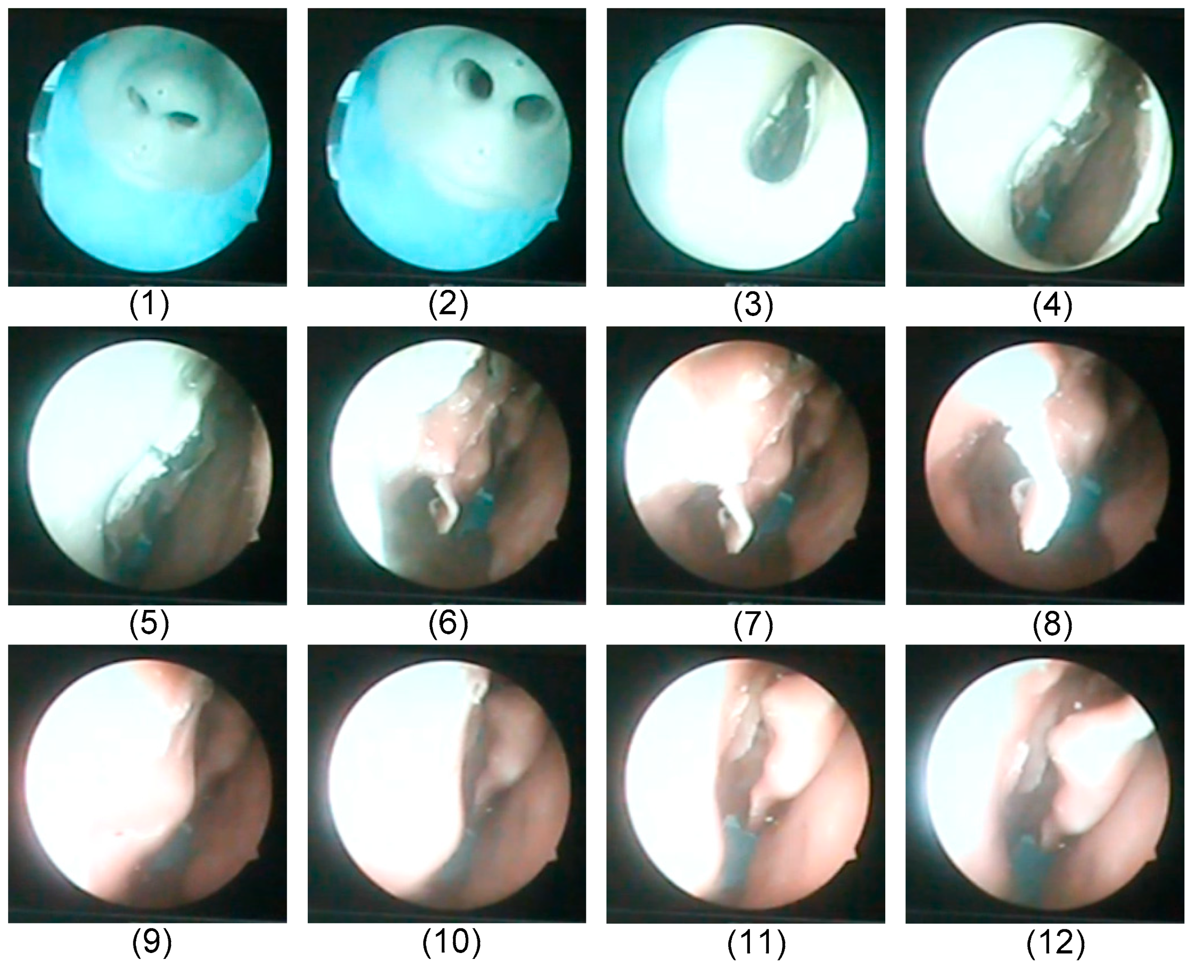 Applsci 09 01659 g017