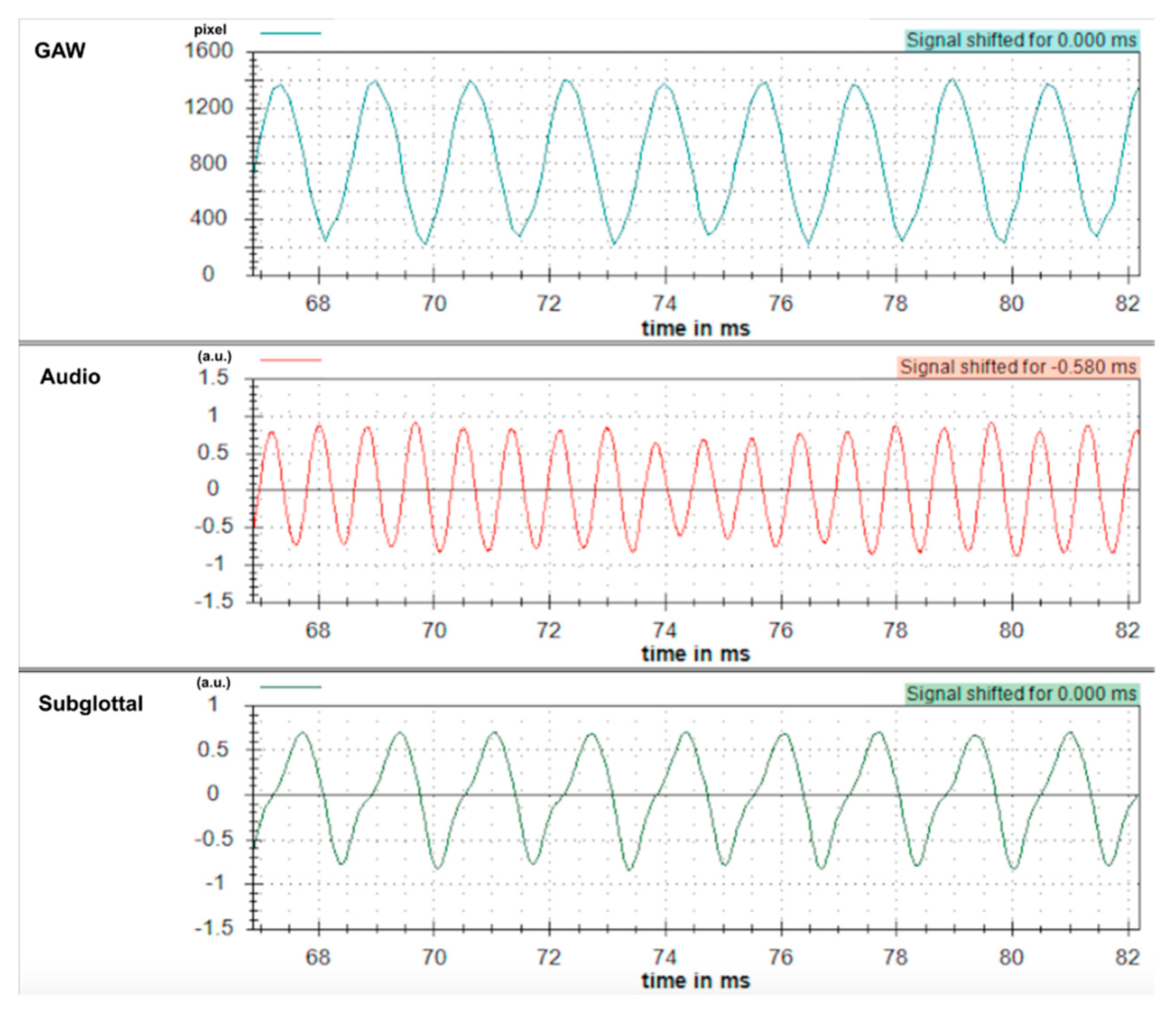 Applsci 09 01963 g004 Applsci 09 01963 g004