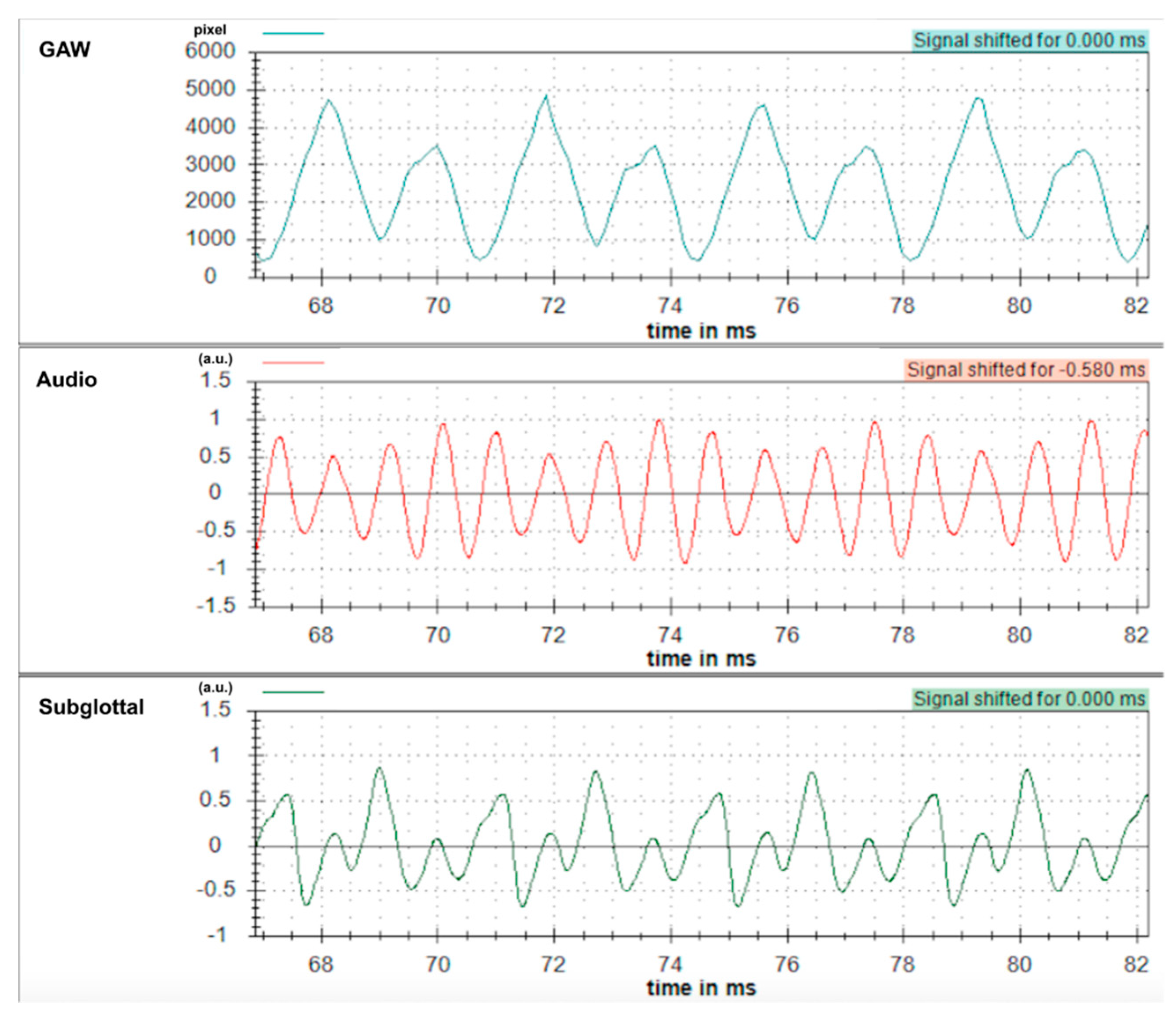 Applsci 09 01963 g005 Applsci 09 01963 g005