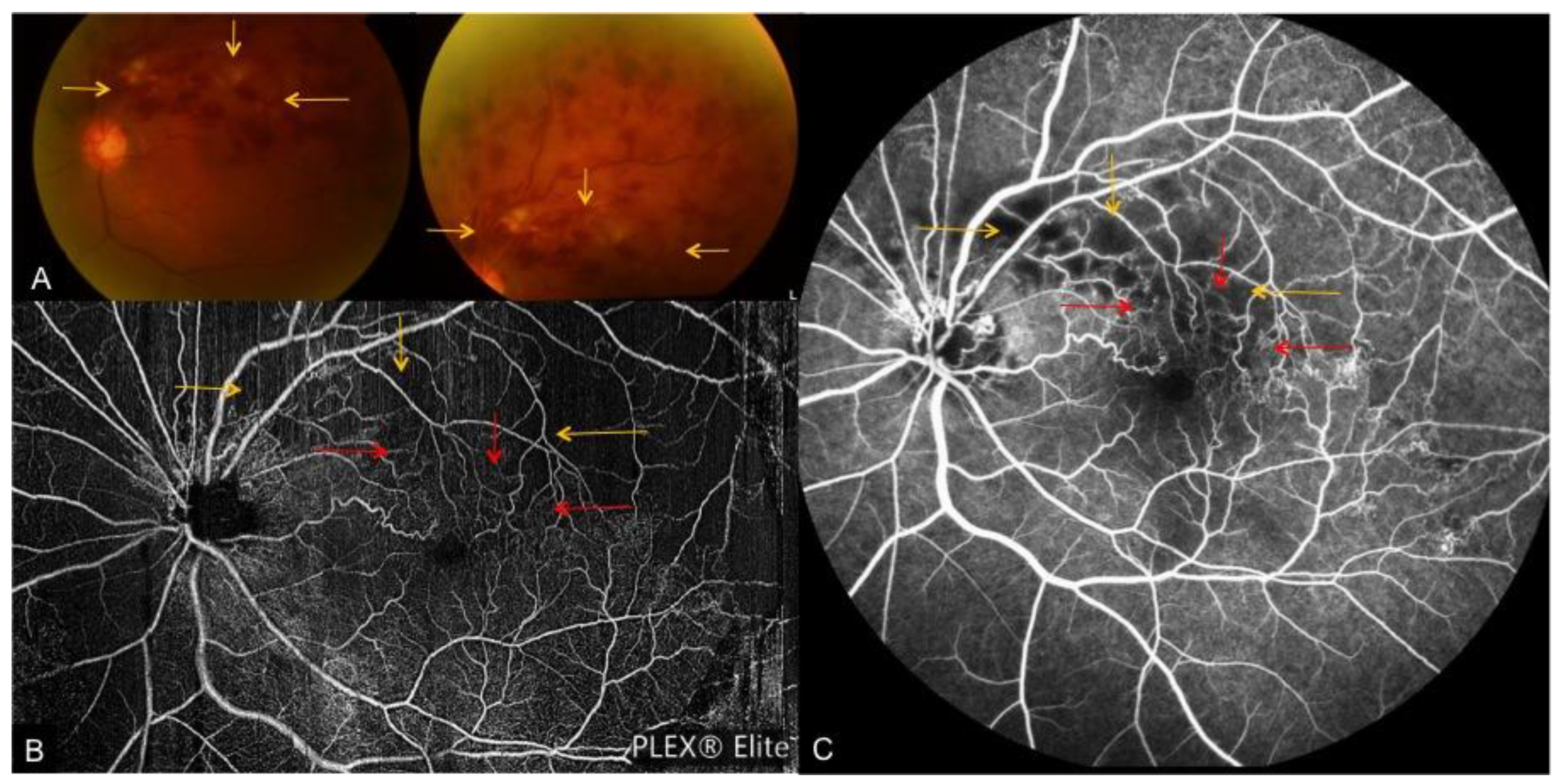 Applsci 09 02577 g004