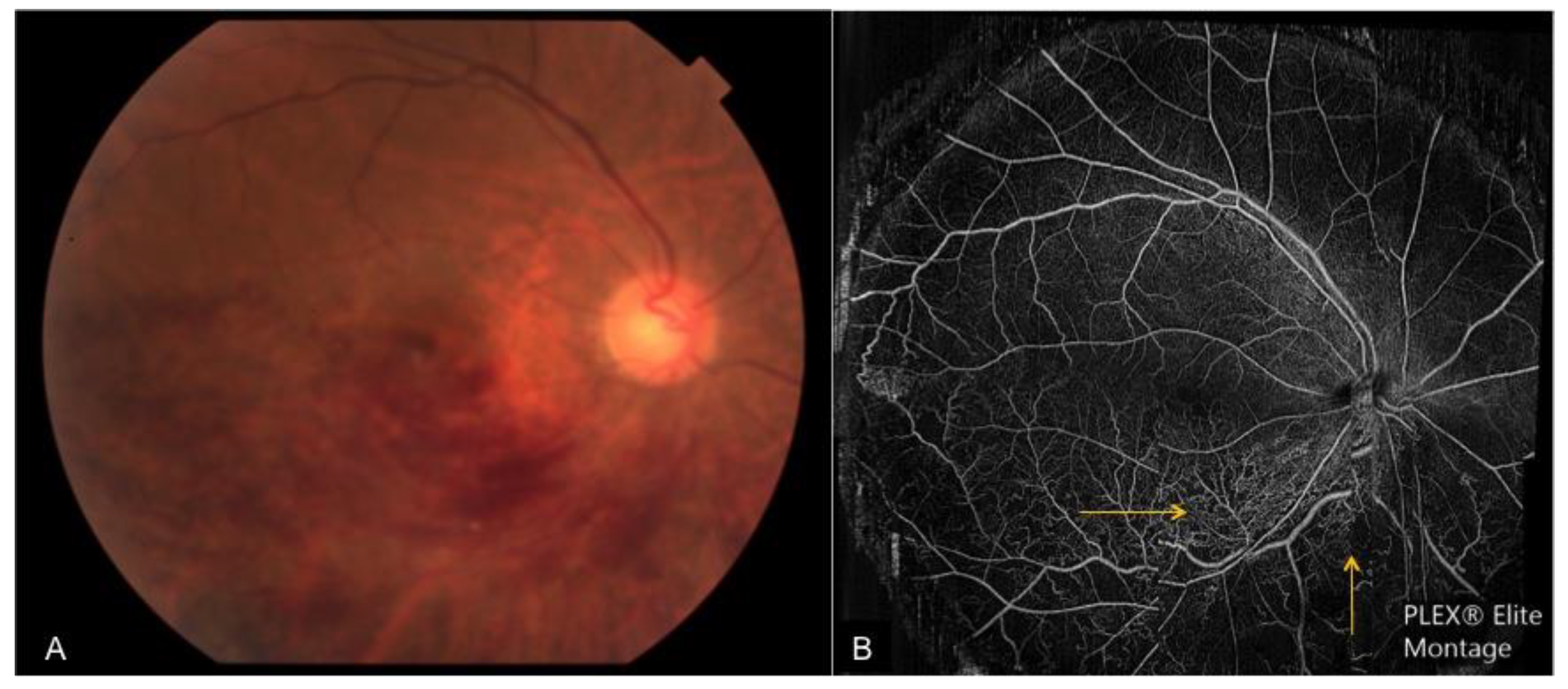 Applsci 09 02577 g005