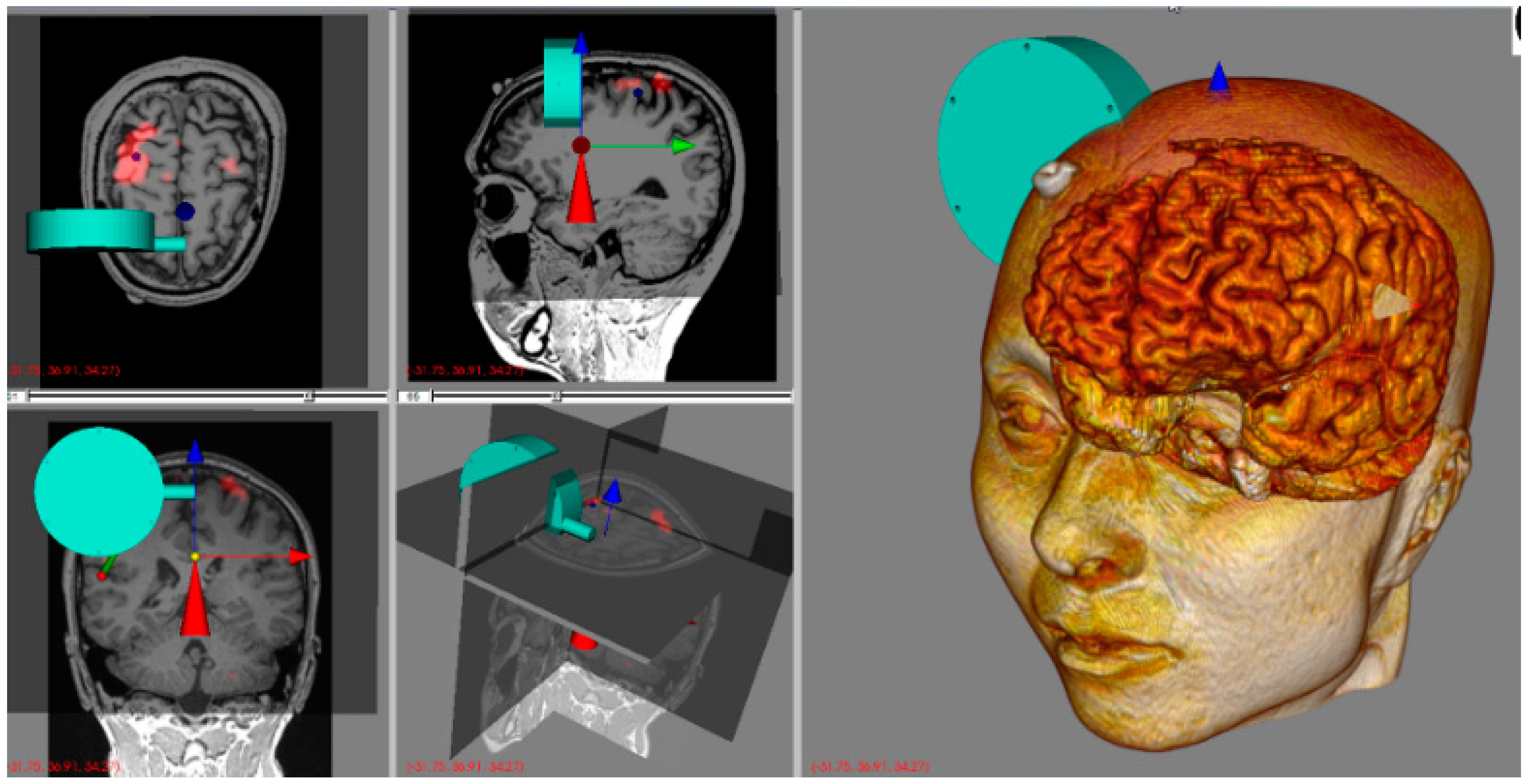 Applsci 09 04561 g006